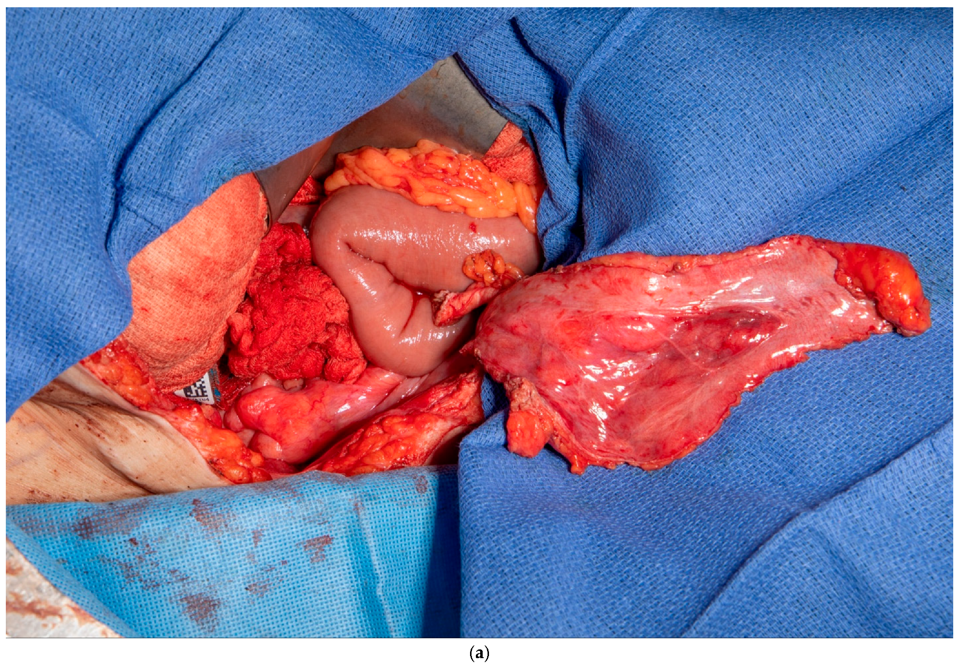 Medicina 61 01153 g003a