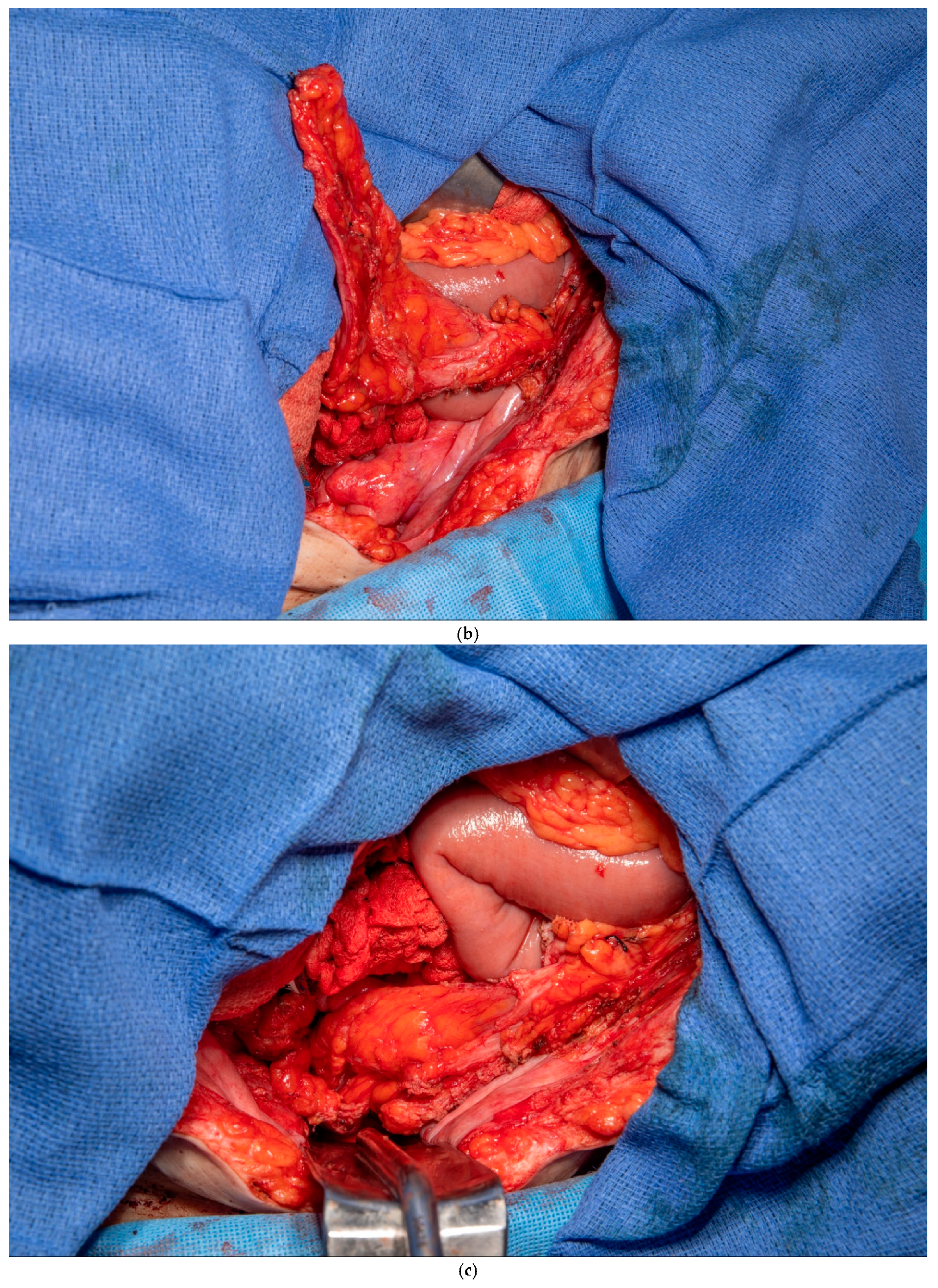 Medicina 61 01153 g003b