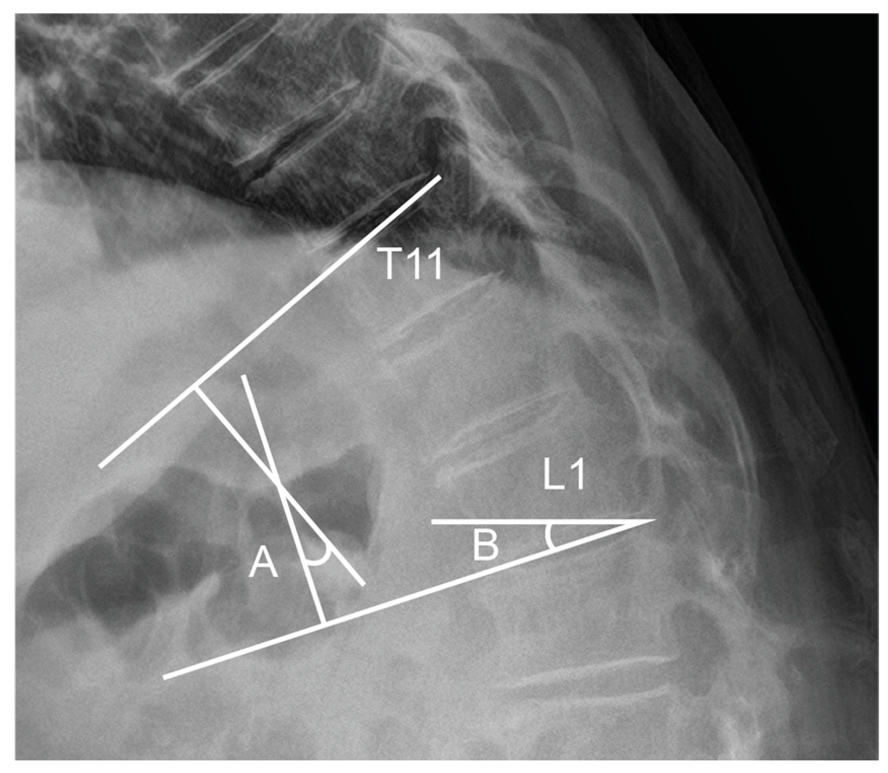 Medicina 61 01192 g003