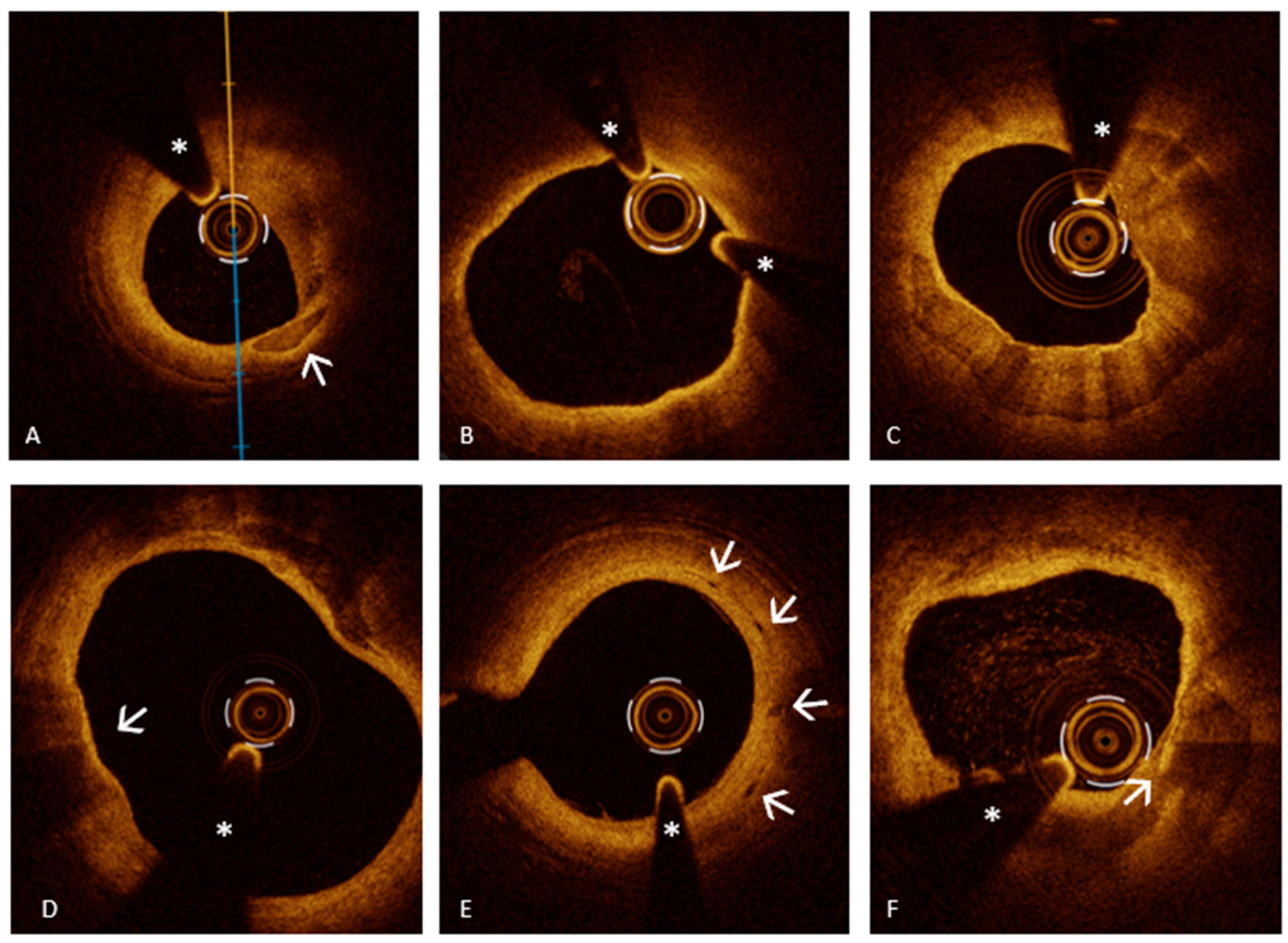 Medicina 61 01218 g004