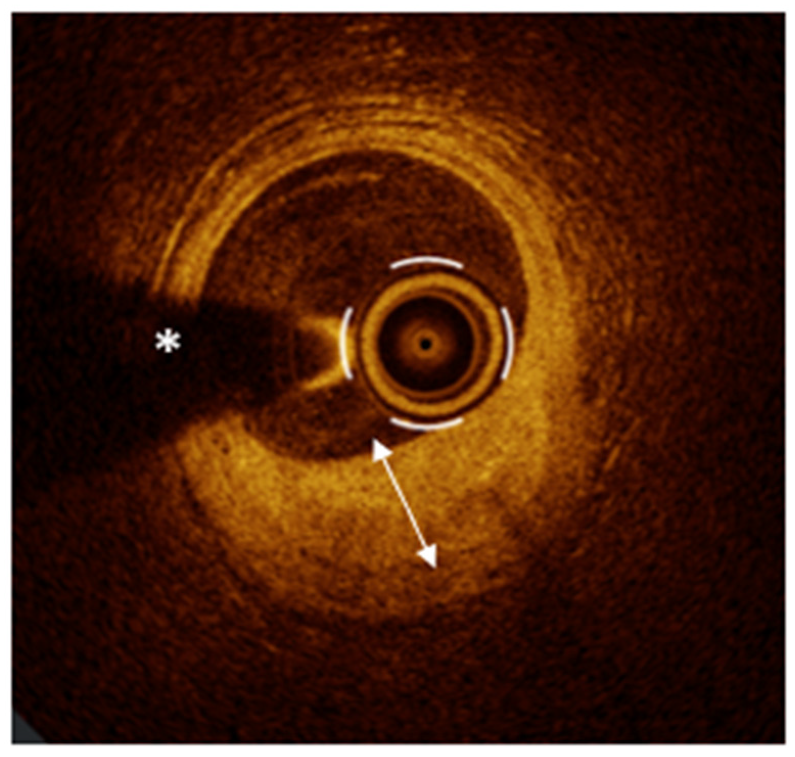 Medicina 61 01218 g005