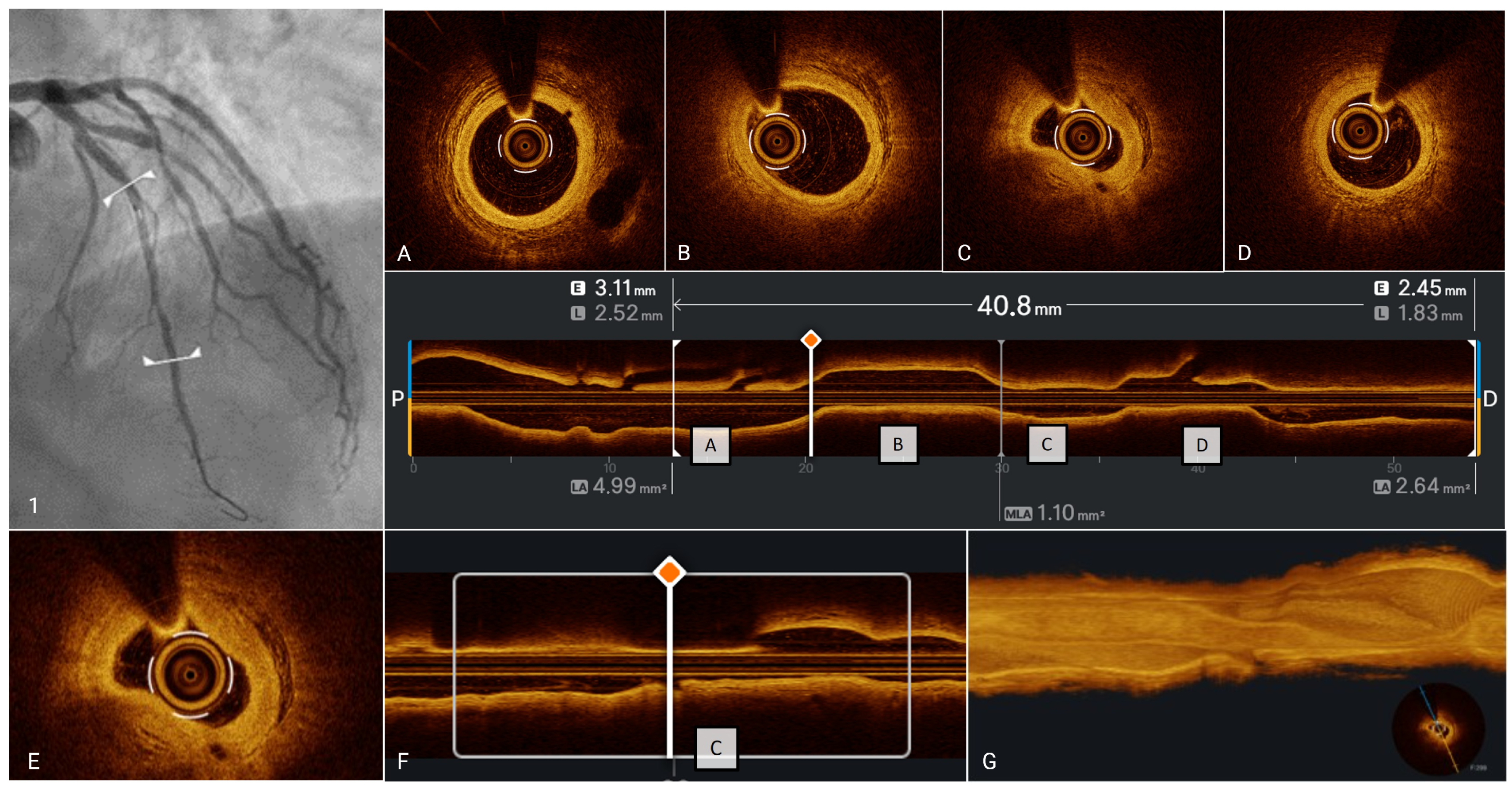 Medicina 61 01218 g006