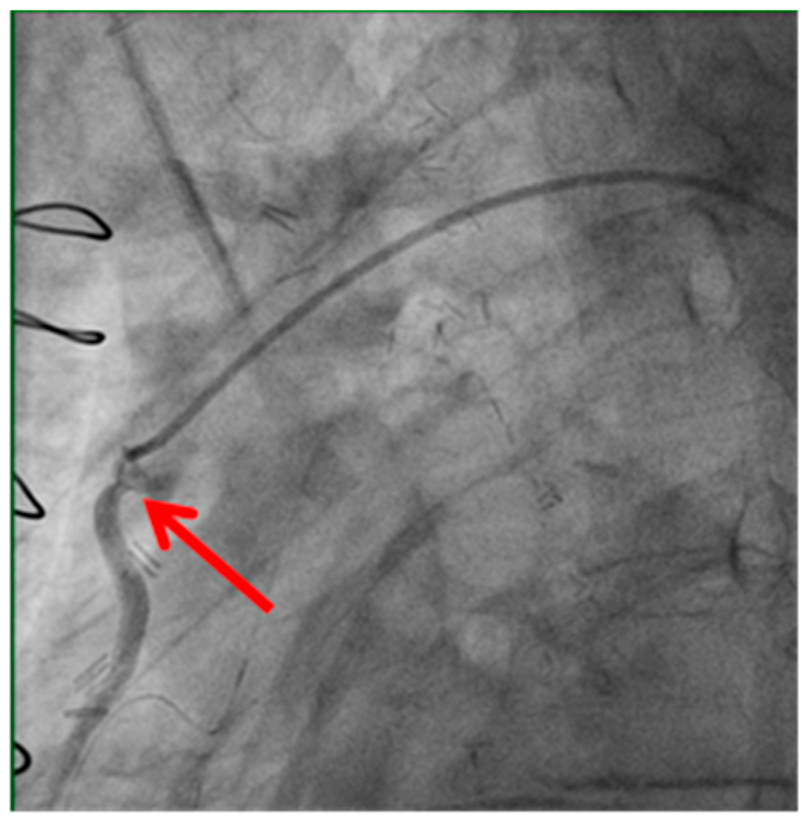 Medicina 61 01241 g001