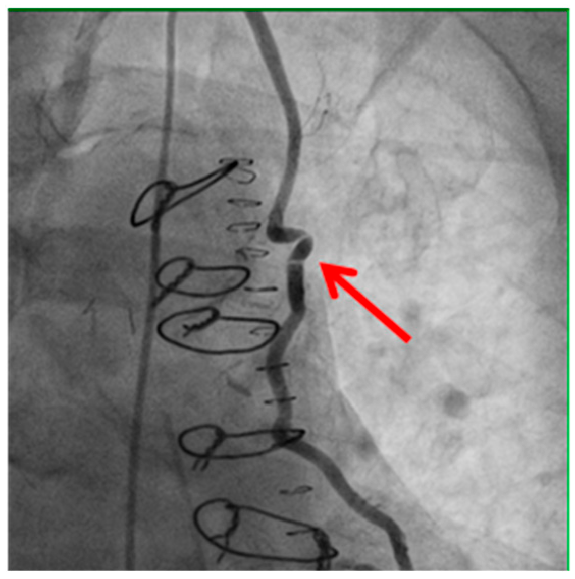 Medicina 61 01241 g002