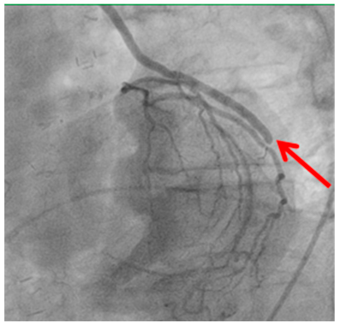 Medicina 61 01241 g003