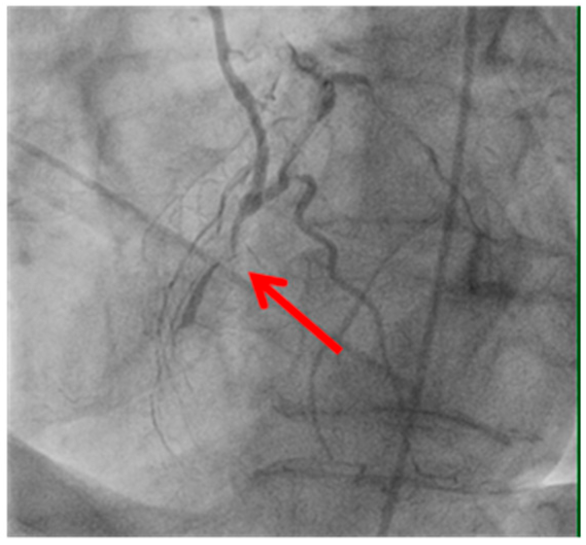 Medicina 61 01241 g004