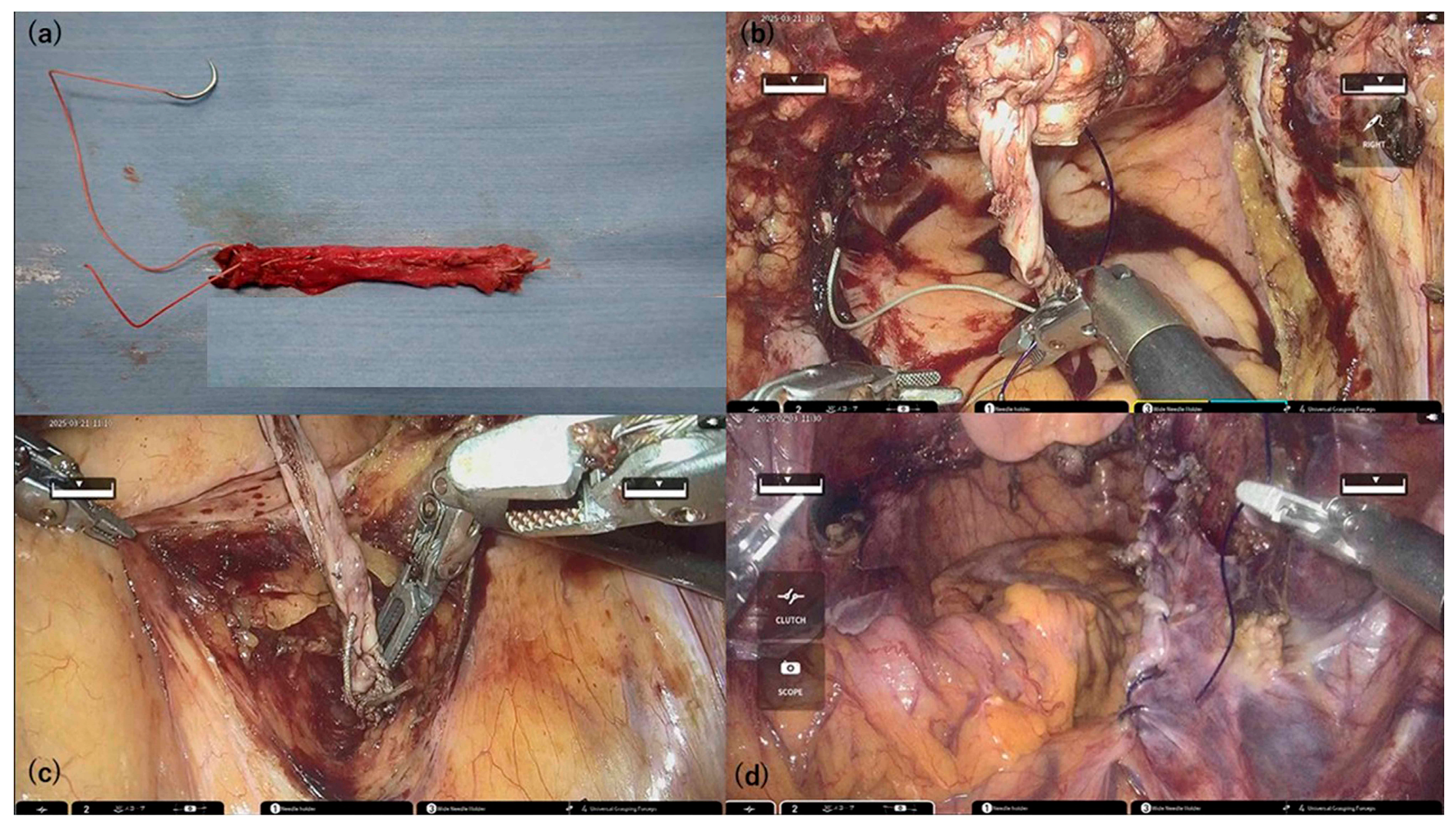 Medicina 61 01242 g002