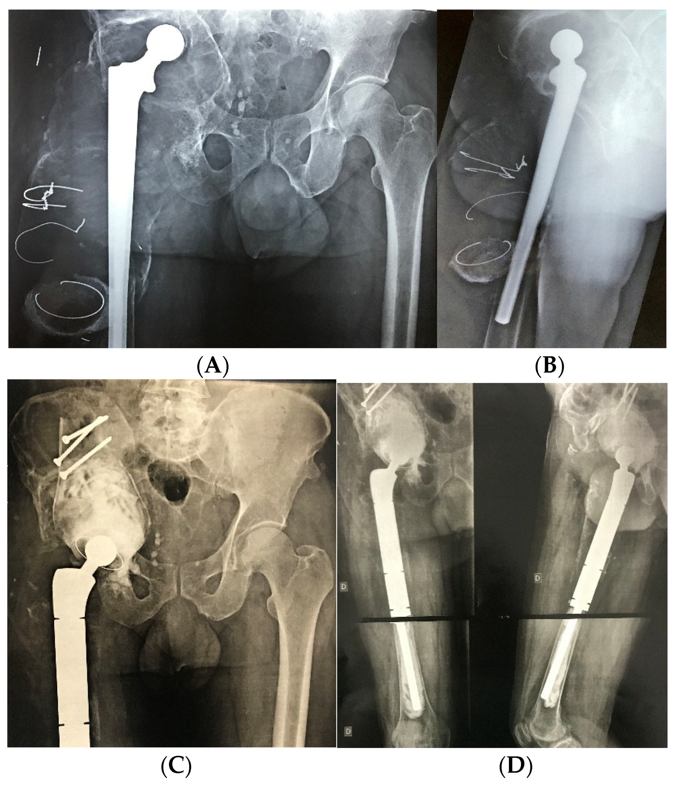 Medicina 61 01246 g001