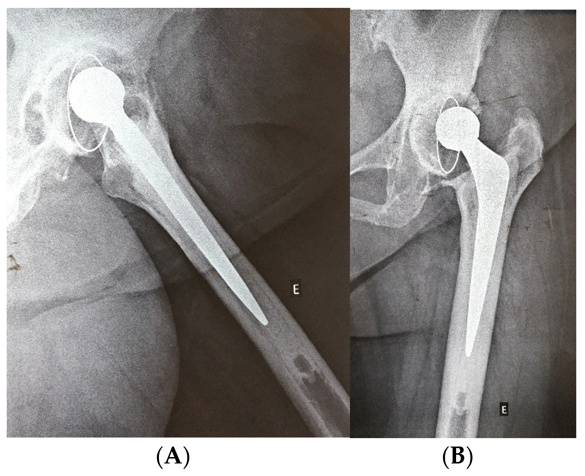 Medicina 61 01246 g002a
