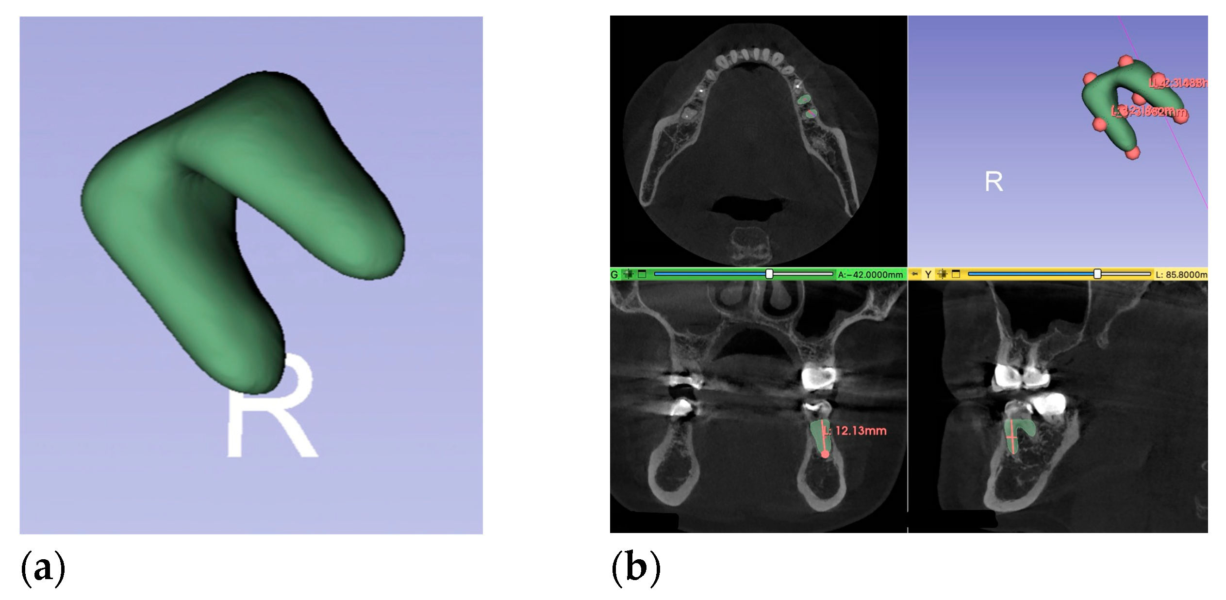 Medicina 61 01261 g004