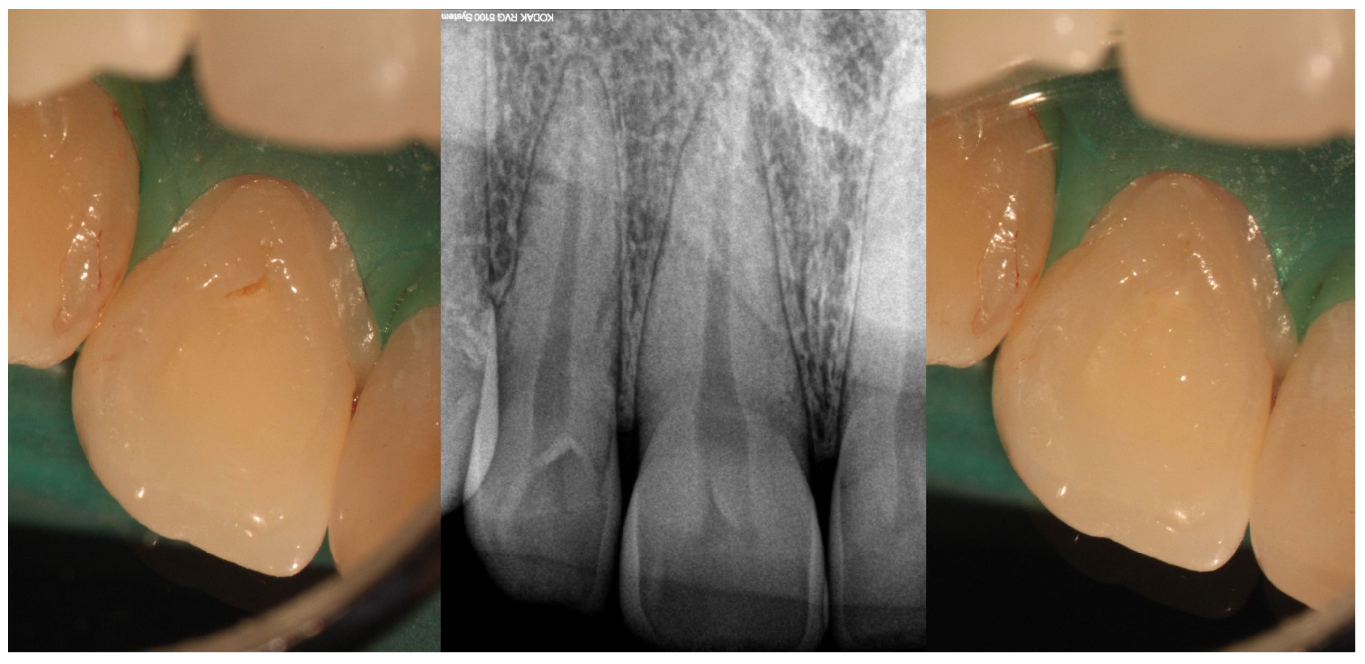 Medicina 61 01281 g001