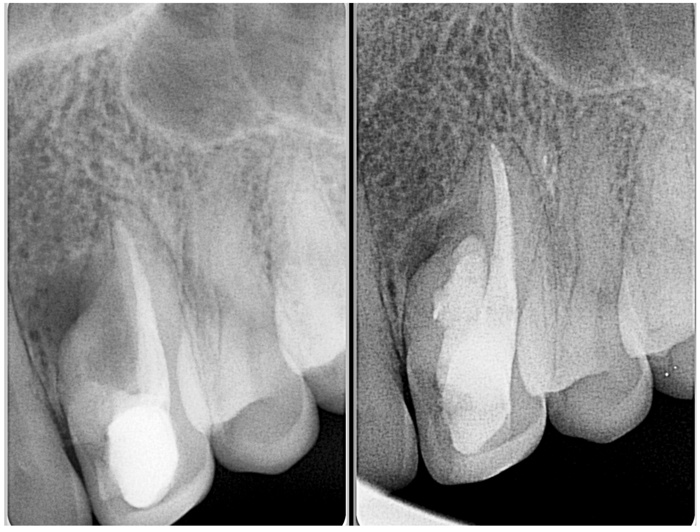 Medicina 61 01281 g006