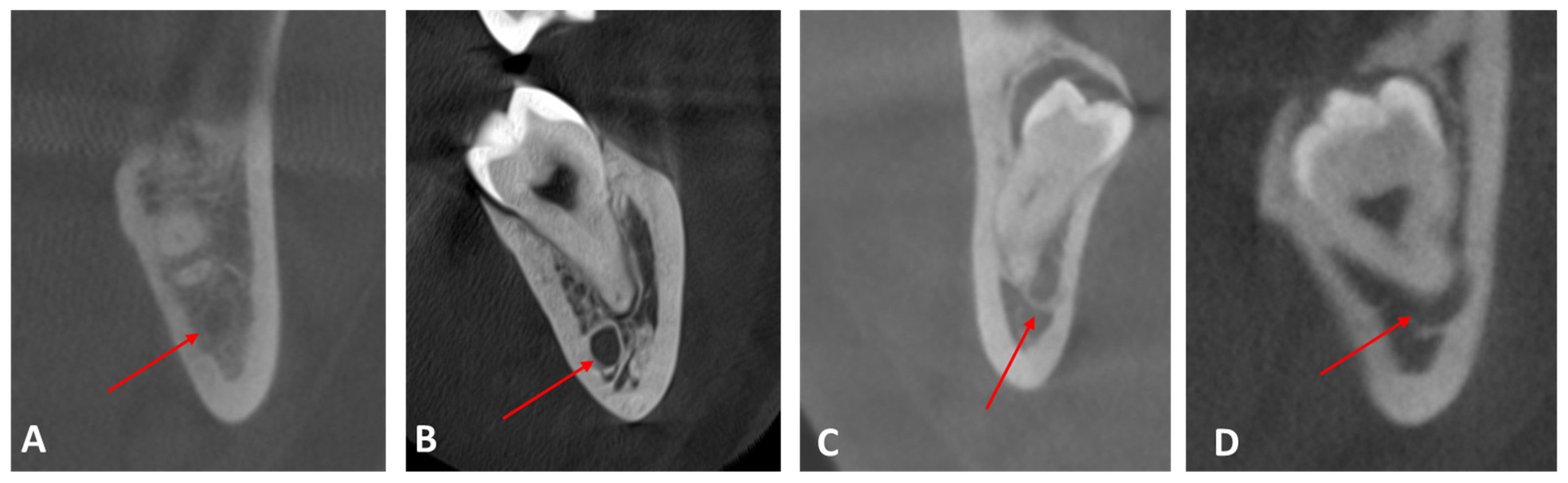 Medicina 61 01291 g002