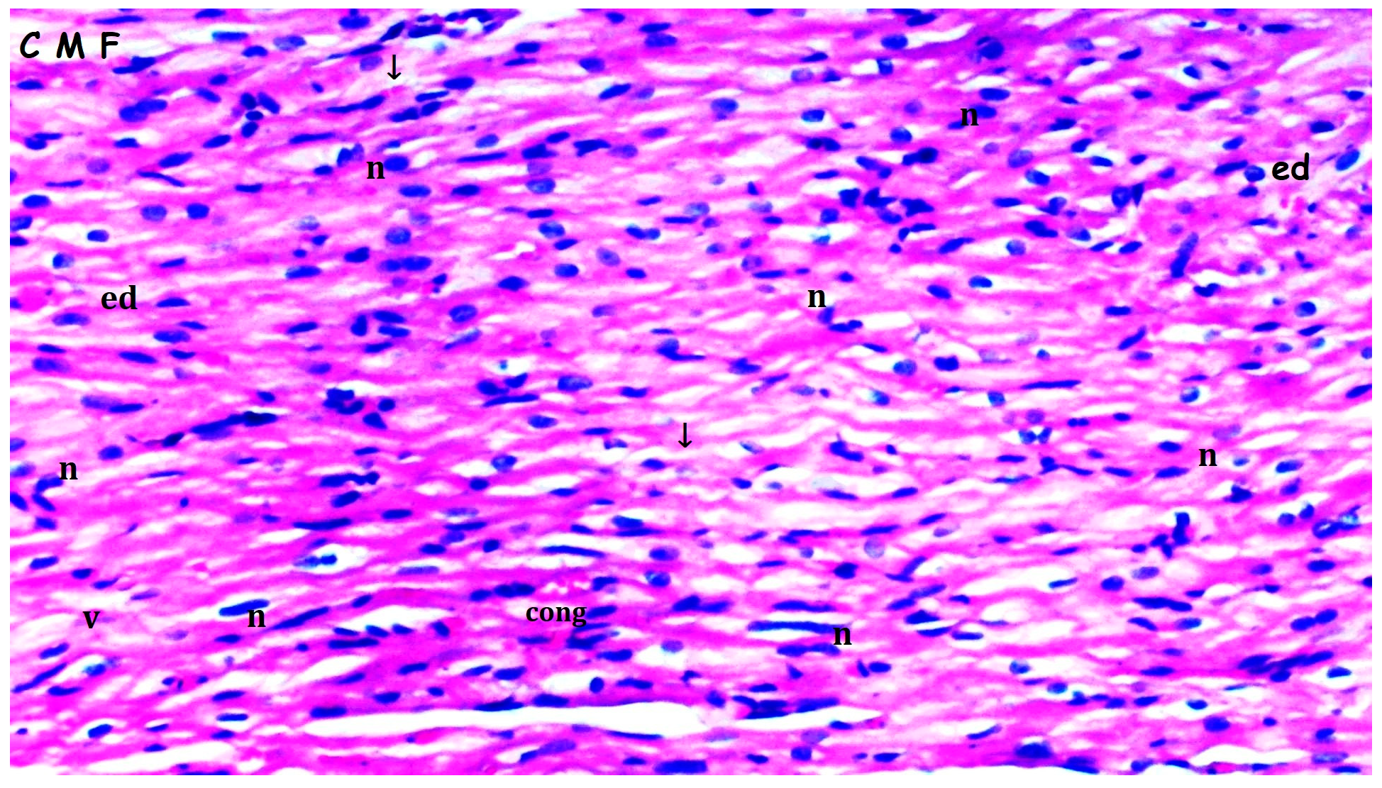 Medicina 61 01298 g005