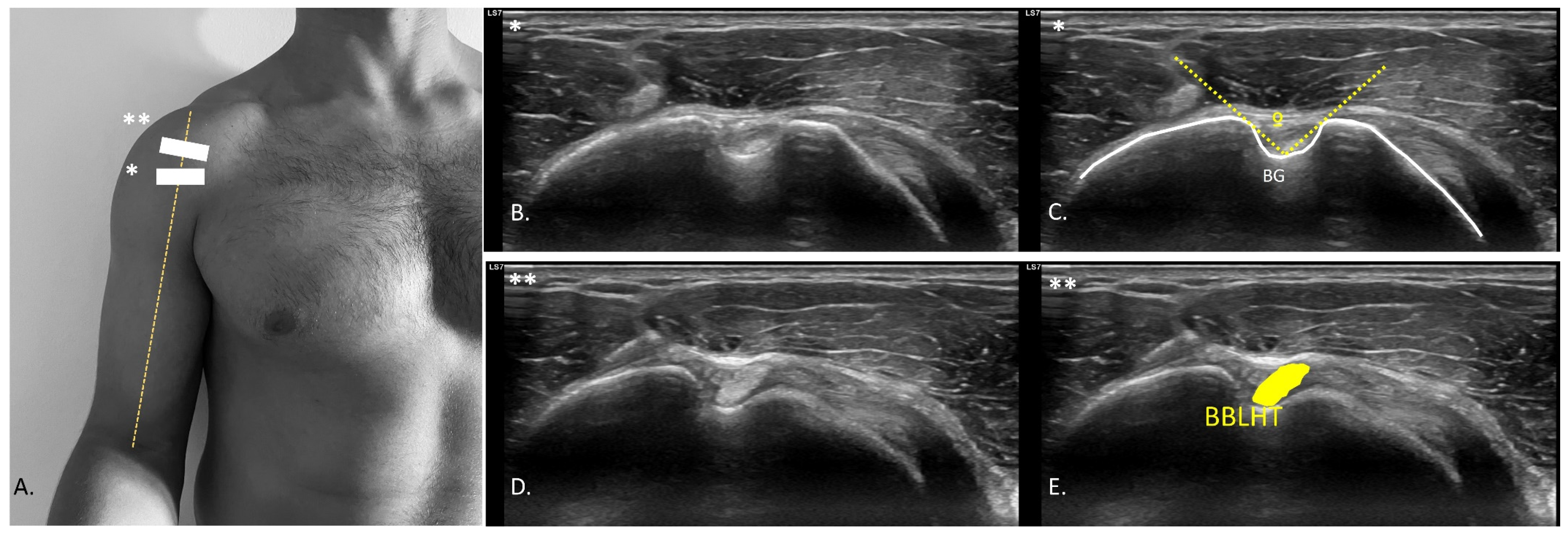Medicina 61 01304 g003