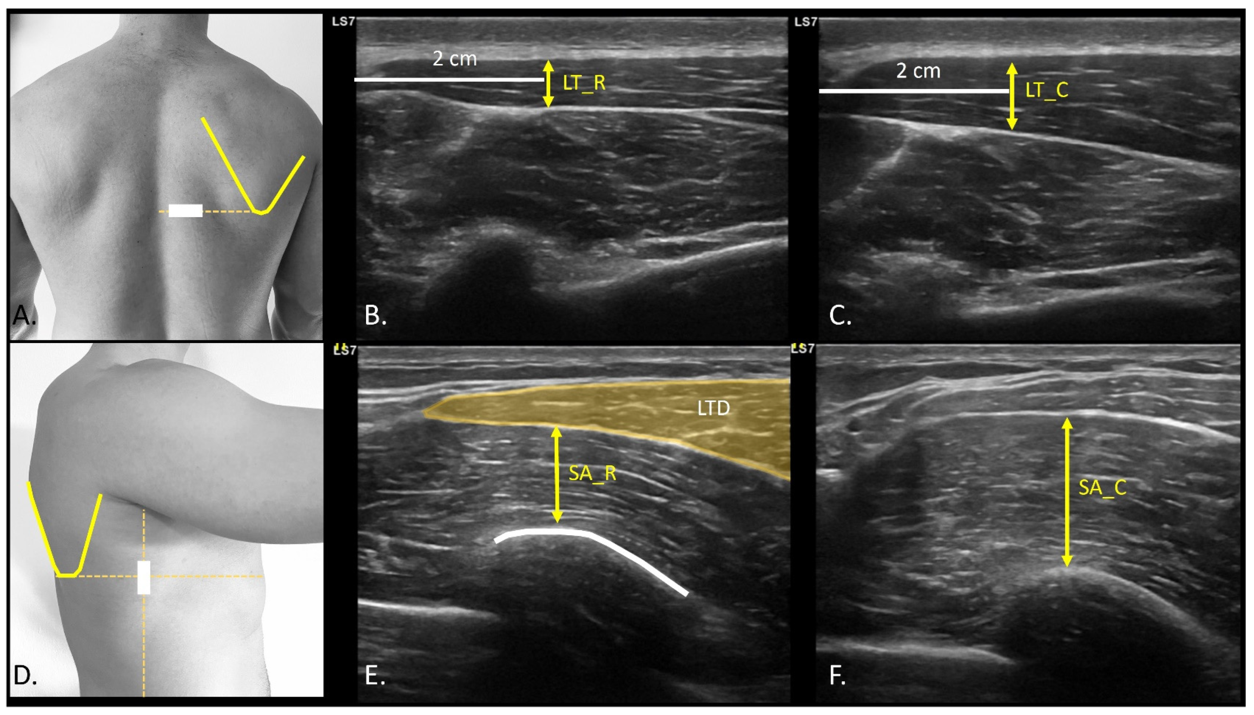 Medicina 61 01304 g004