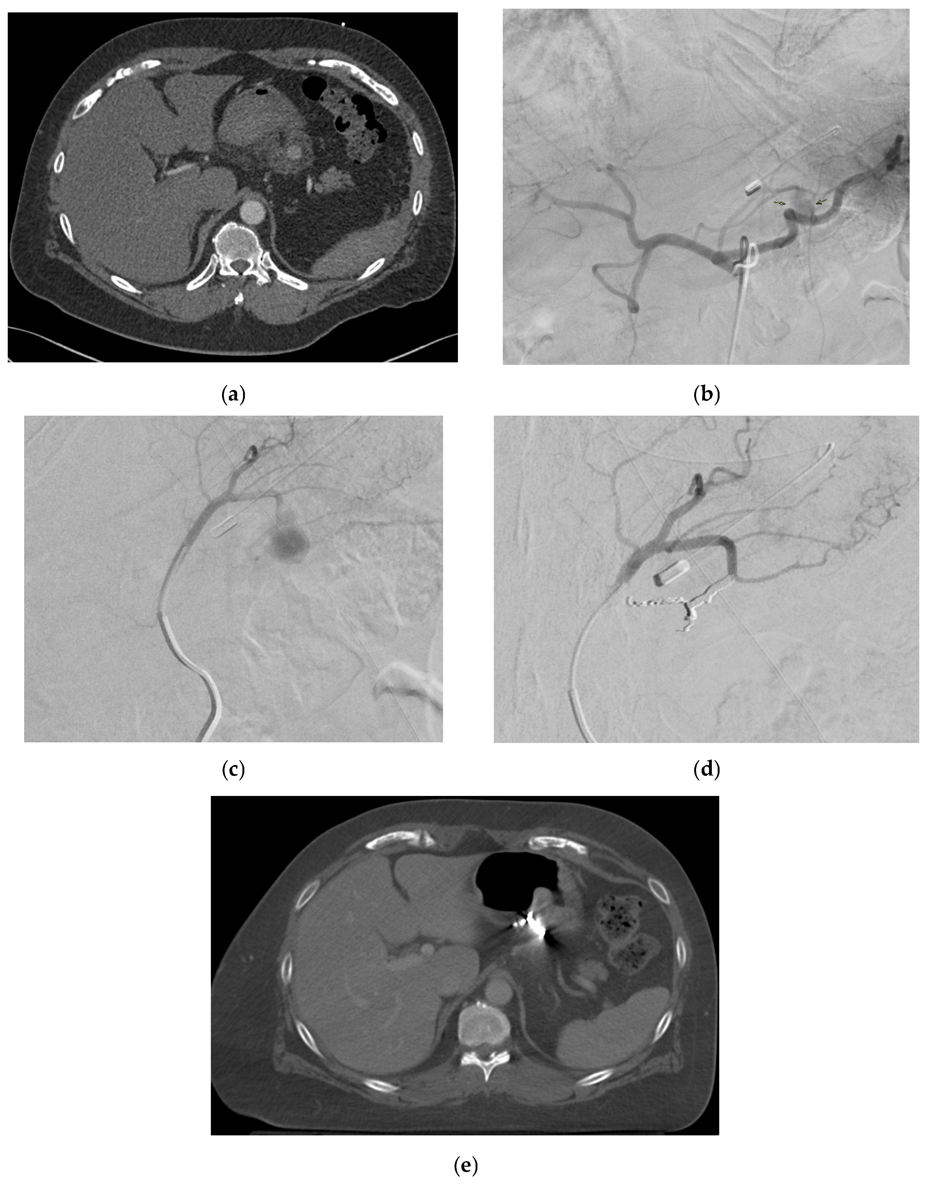 Medicina 61 01312 g003