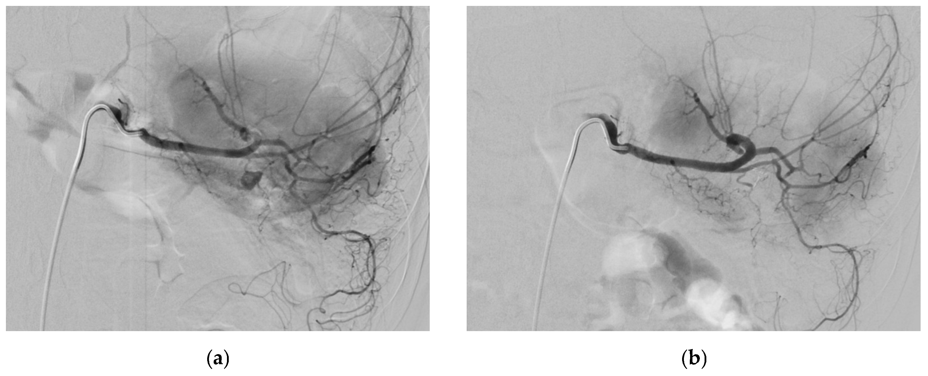 Medicina 61 01312 g004