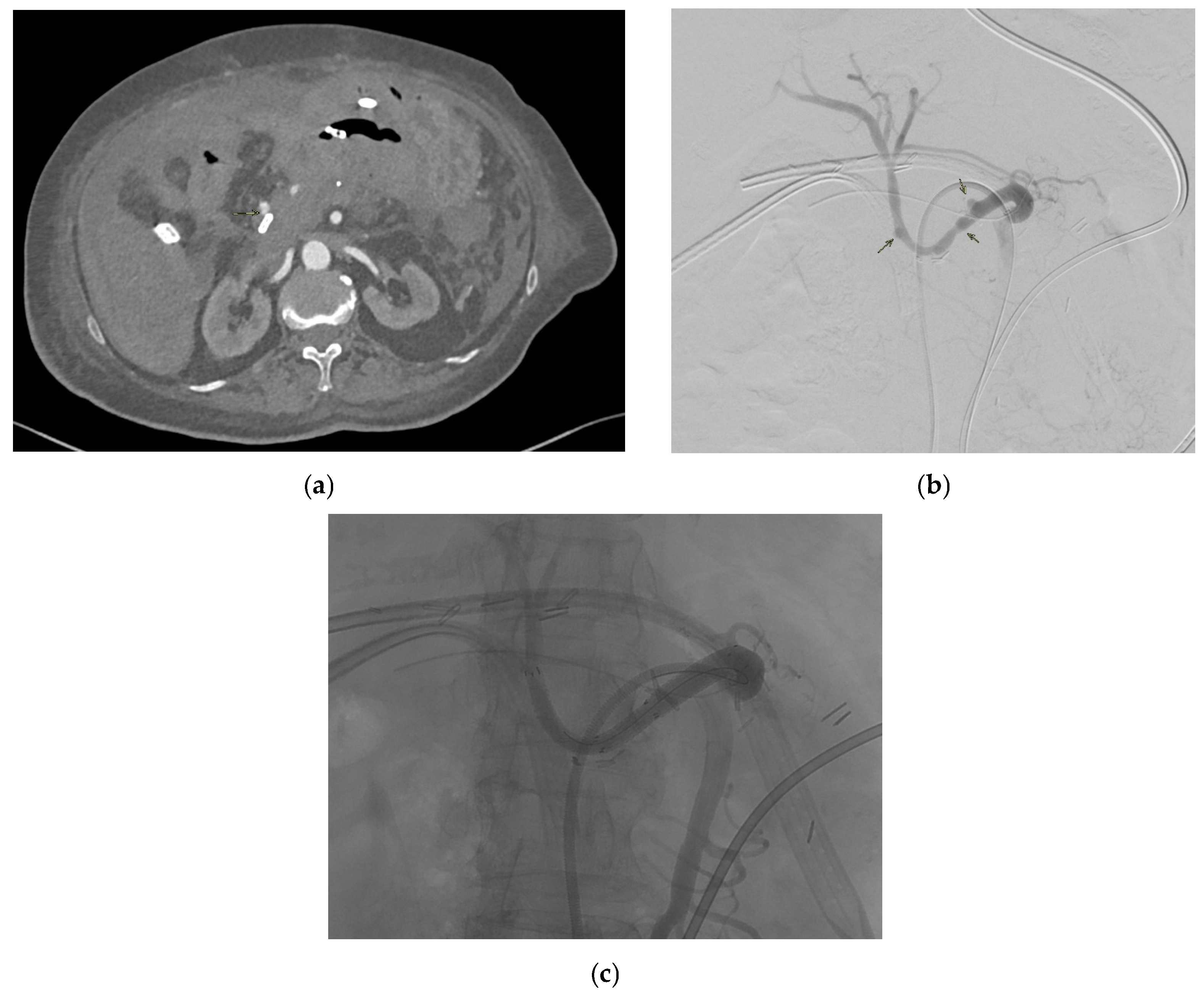 Medicina 61 01312 g005