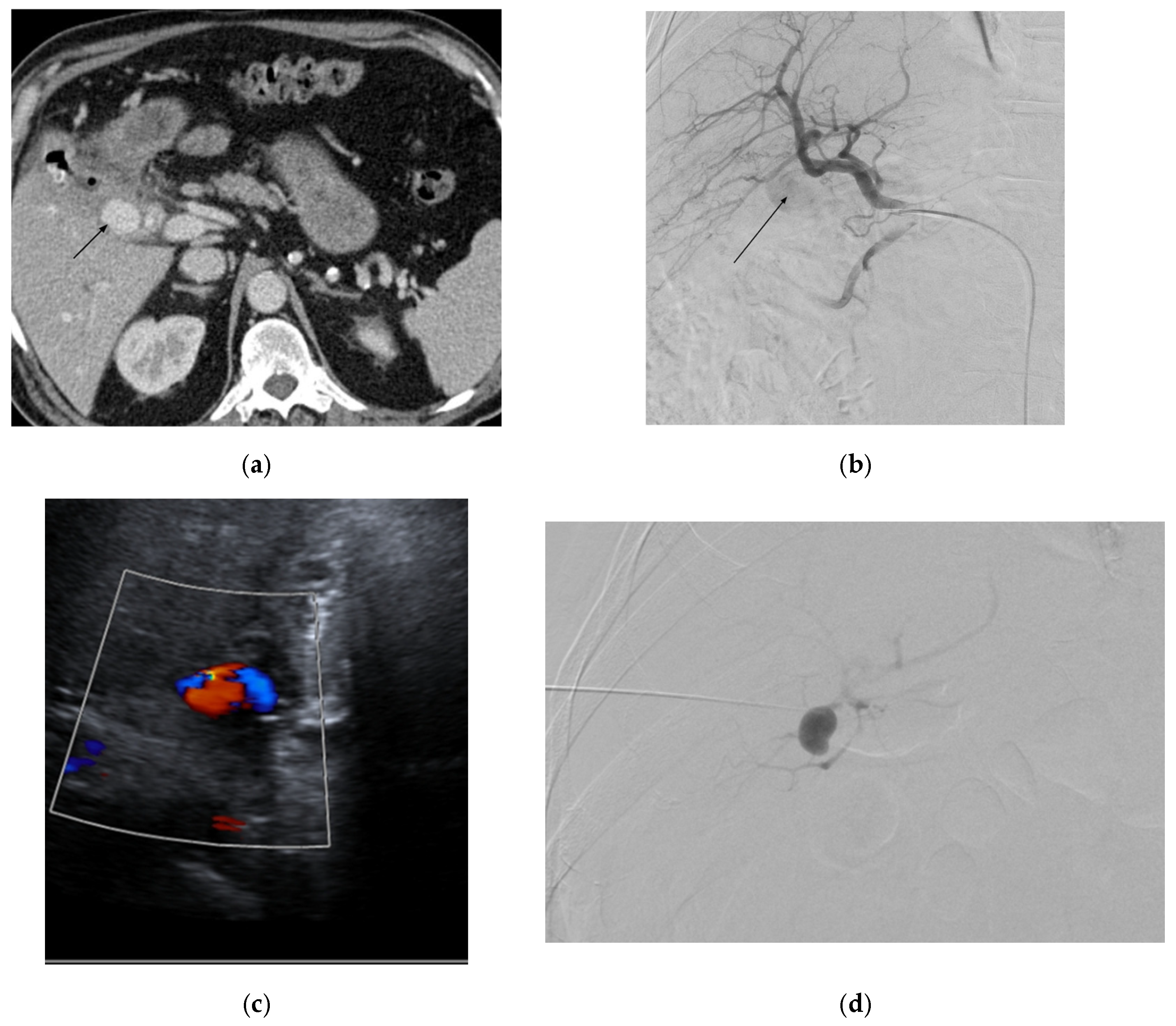 Medicina 61 01312 g007