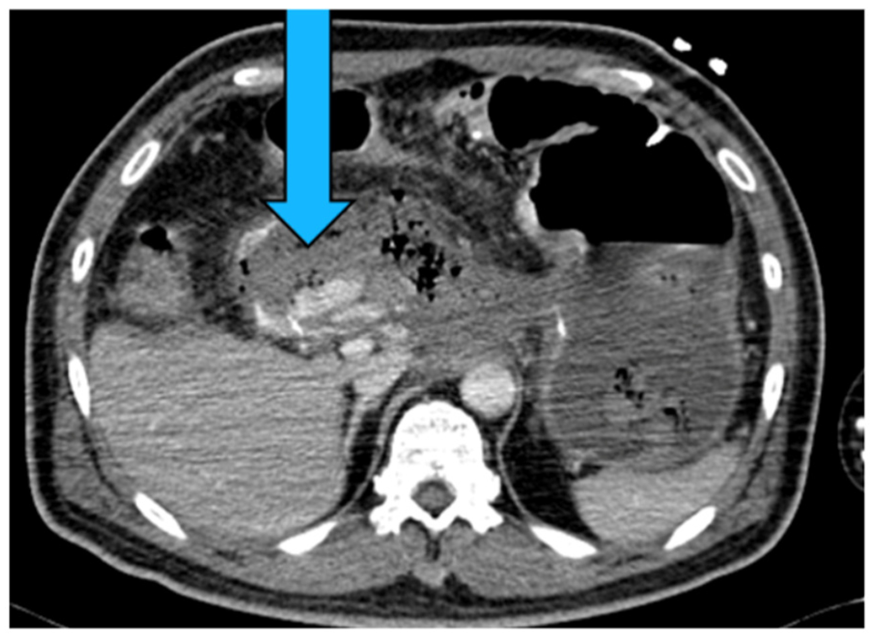 Medicina 61 01312 g009