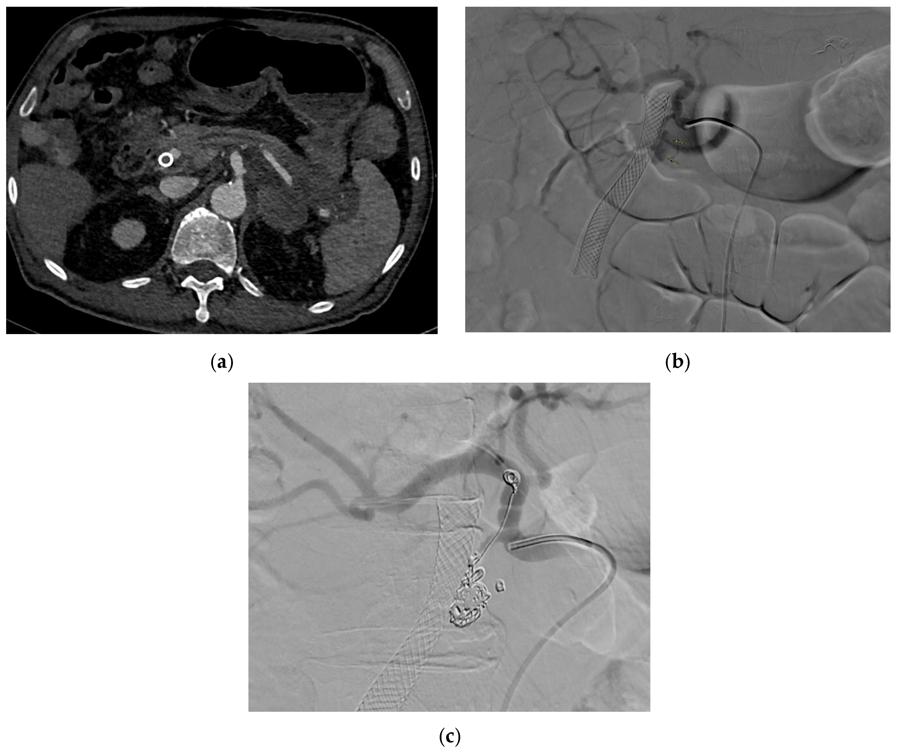 Medicina 61 01312 g010