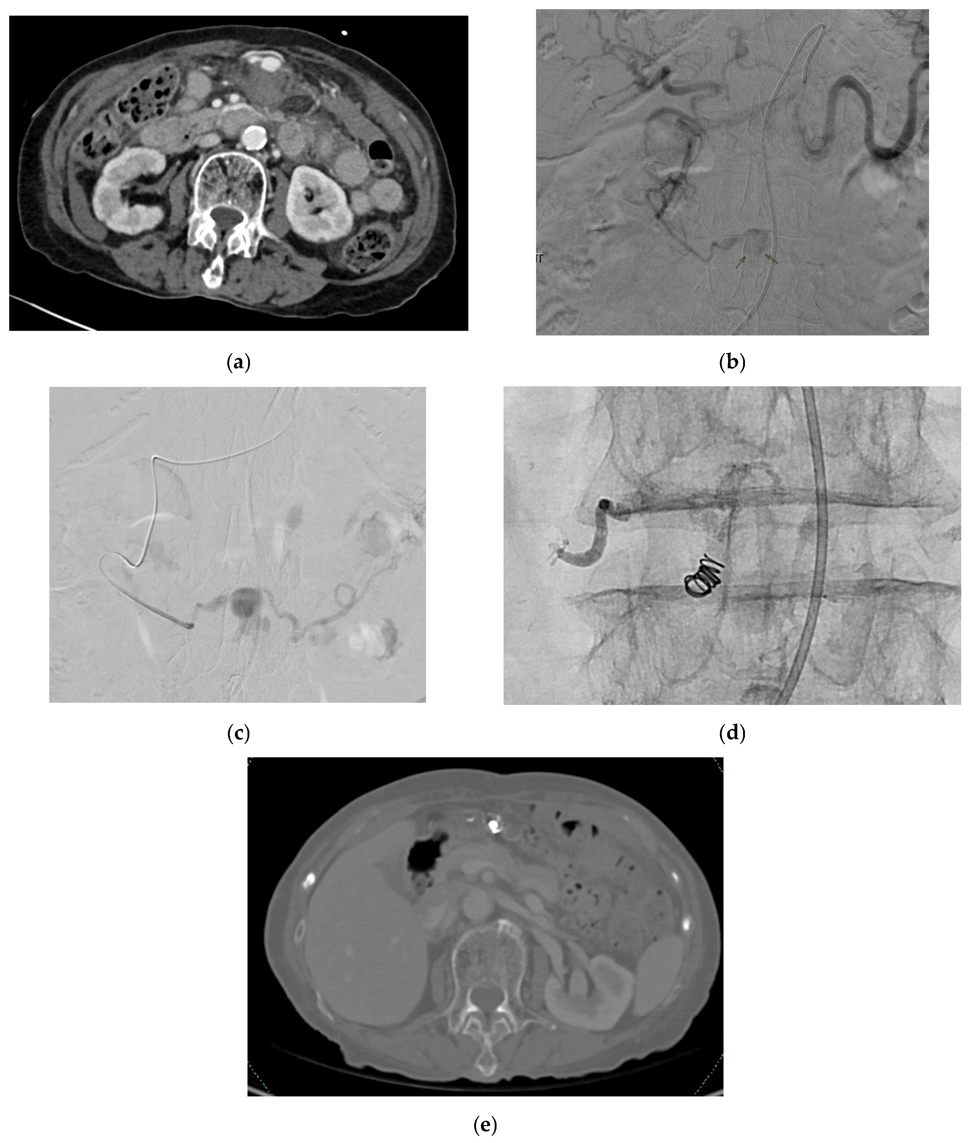 Medicina 61 01312 g011