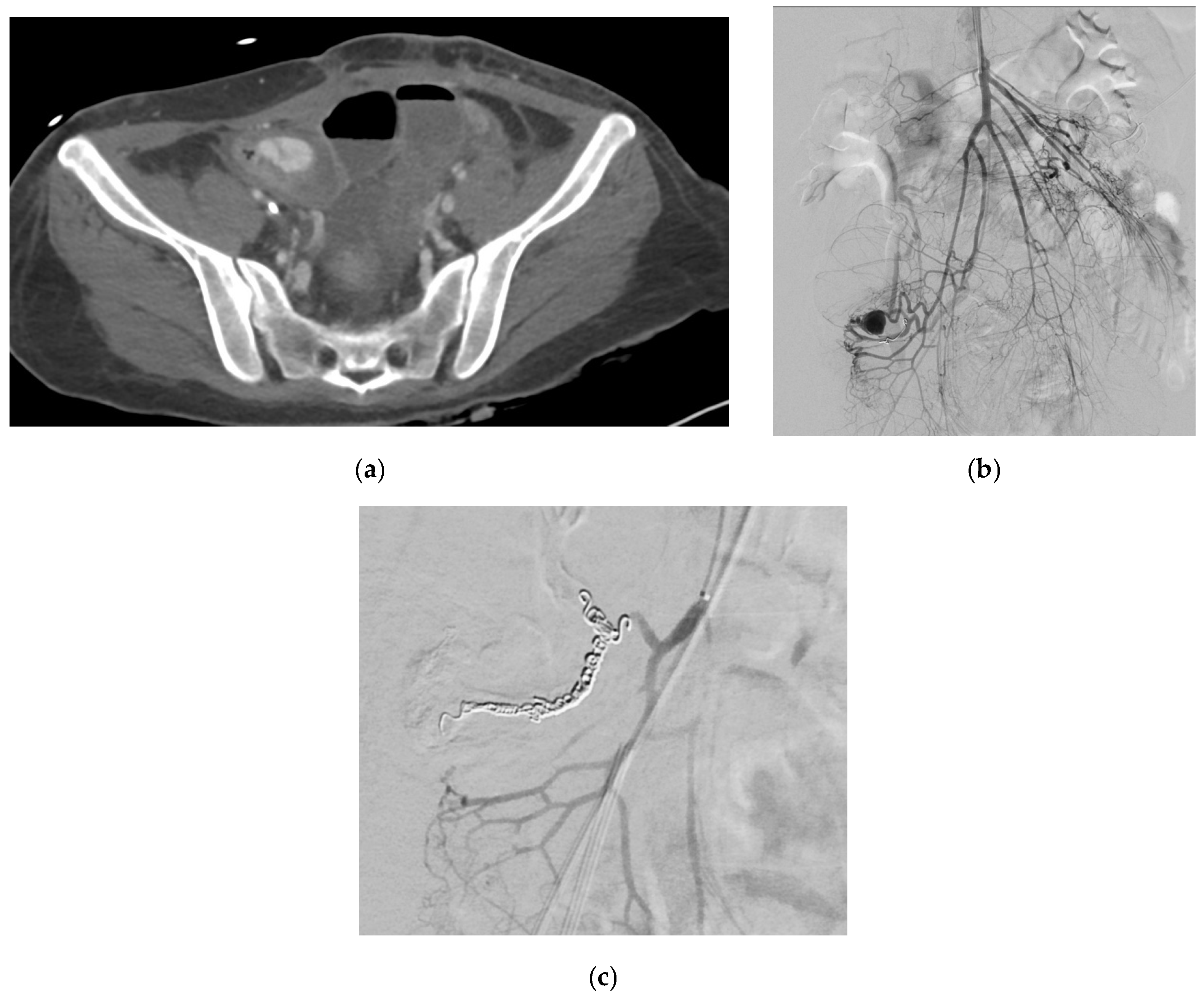 Medicina 61 01312 g013