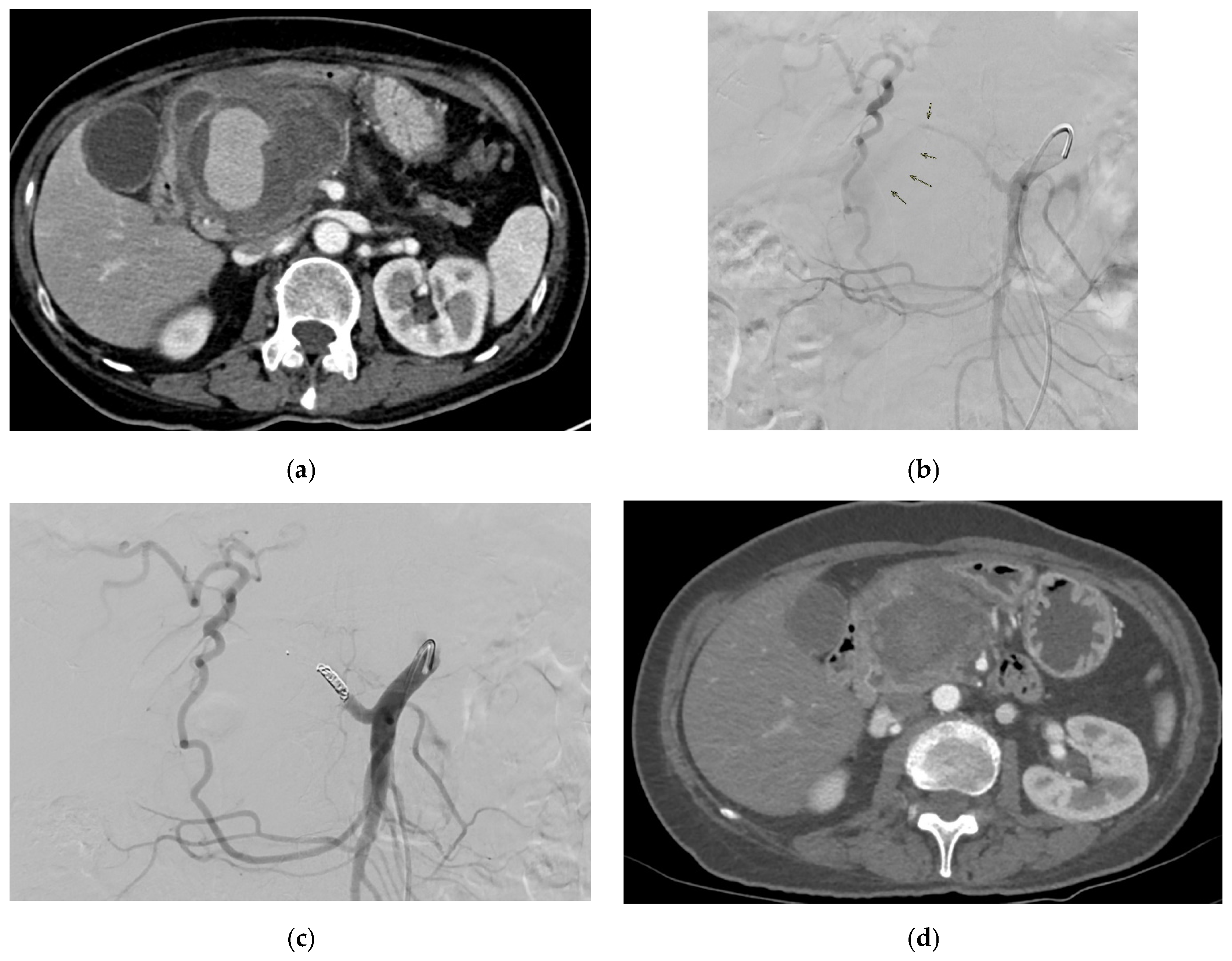 Medicina 61 01312 g014