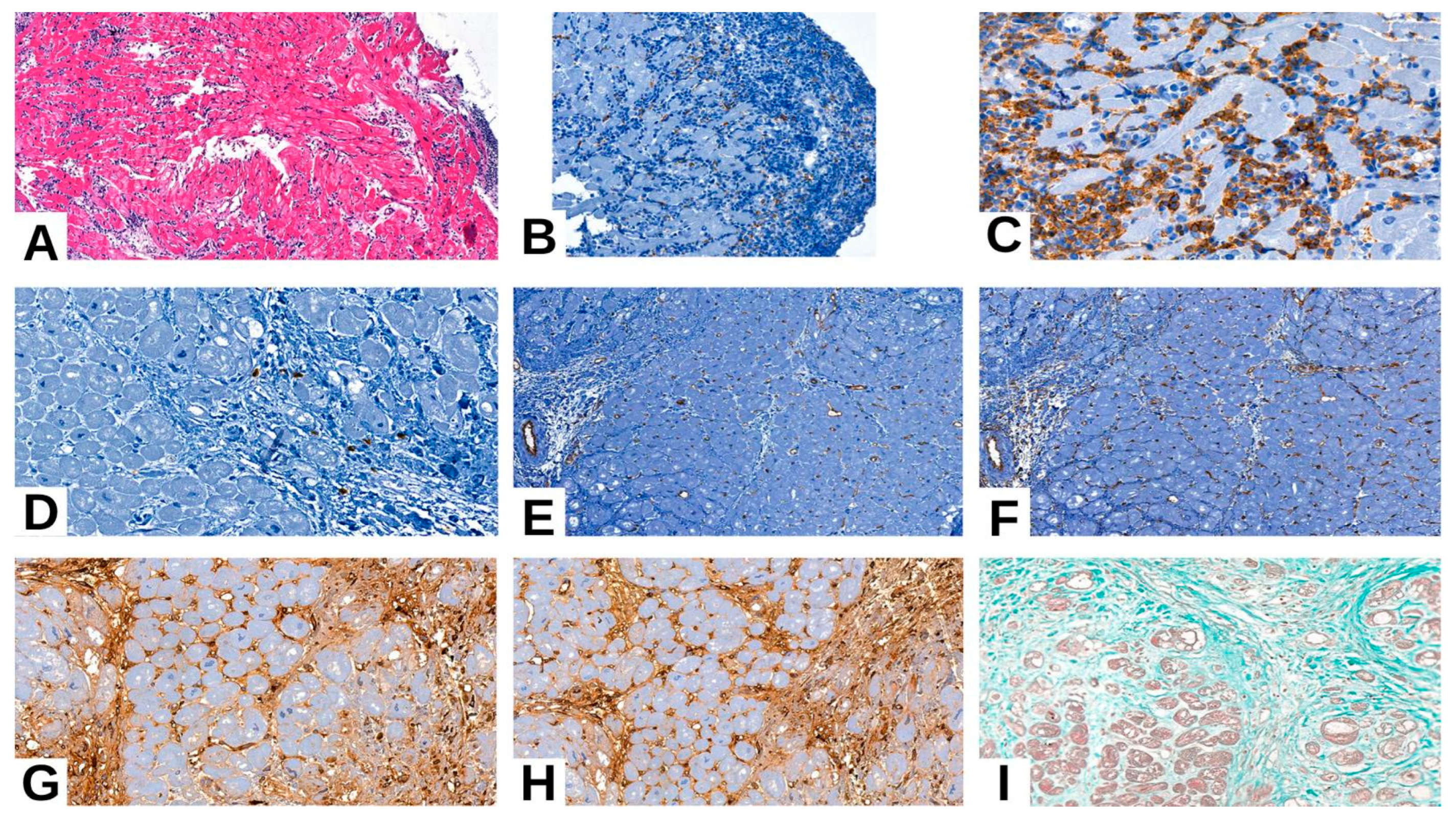Medicina 61 01317 g002