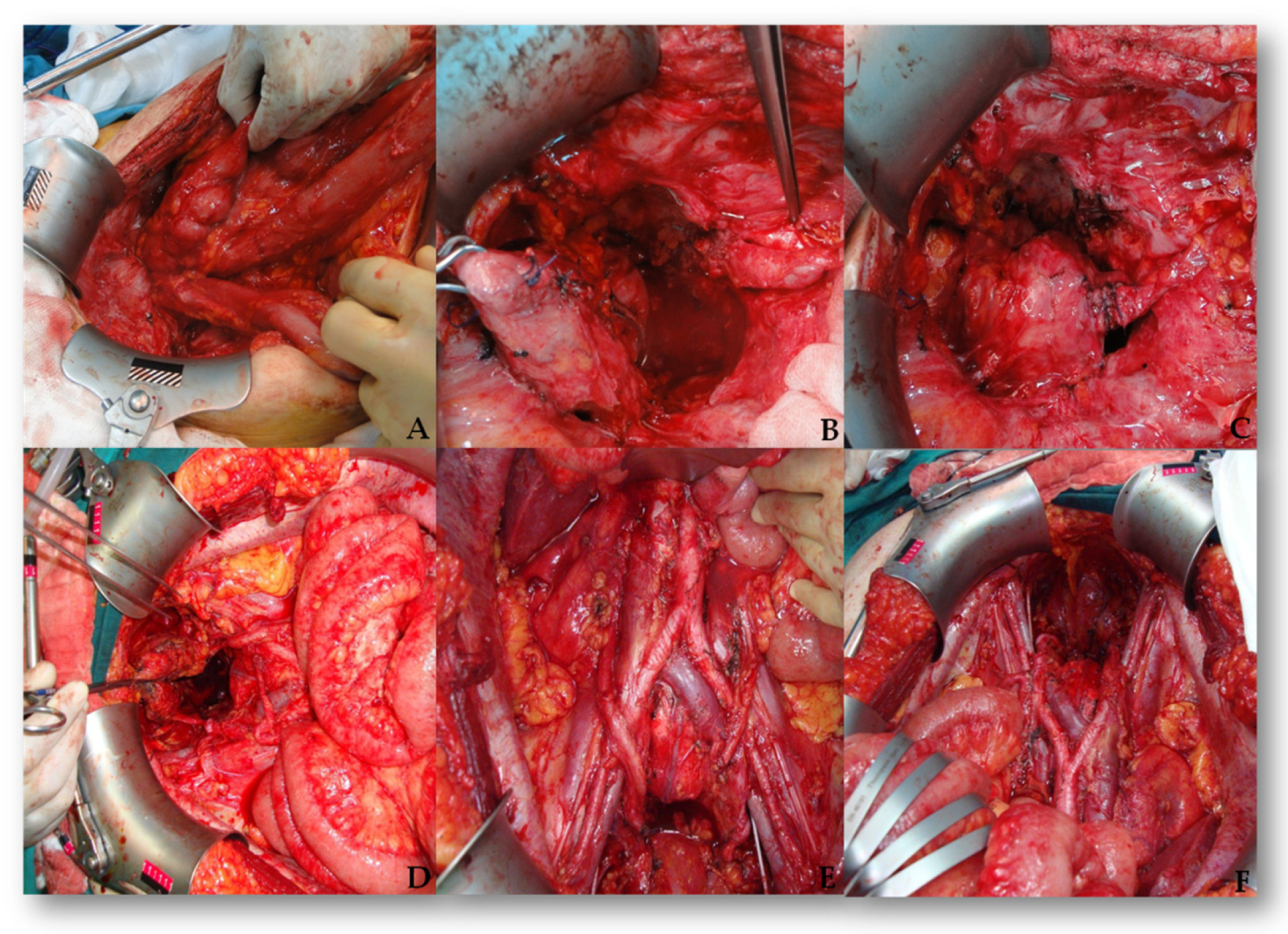 Medicina 61 01331 g001