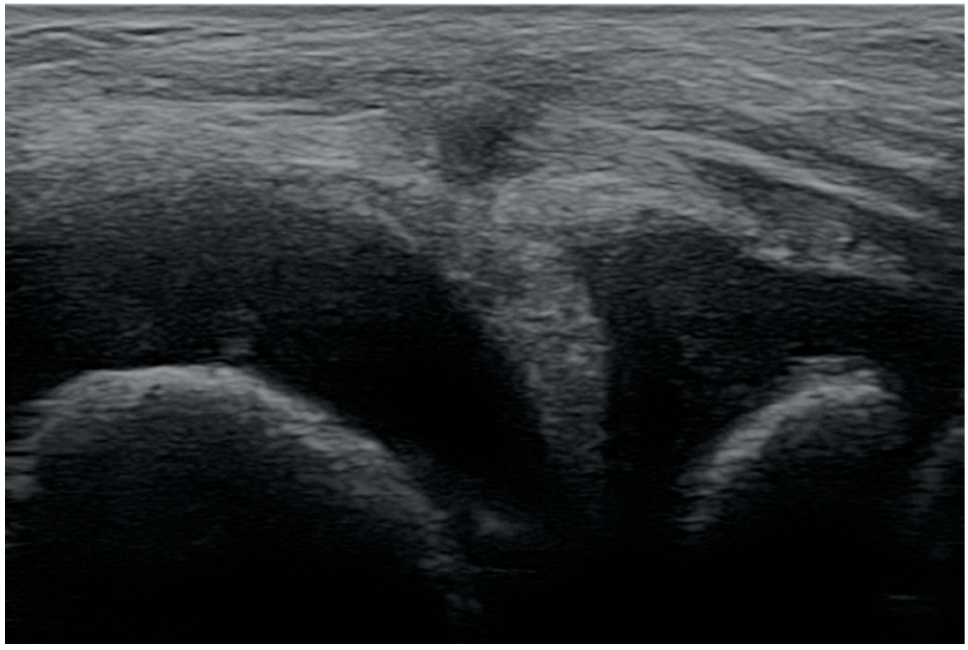 Medicina 61 01339 g004 Medicina 61 01339 g004