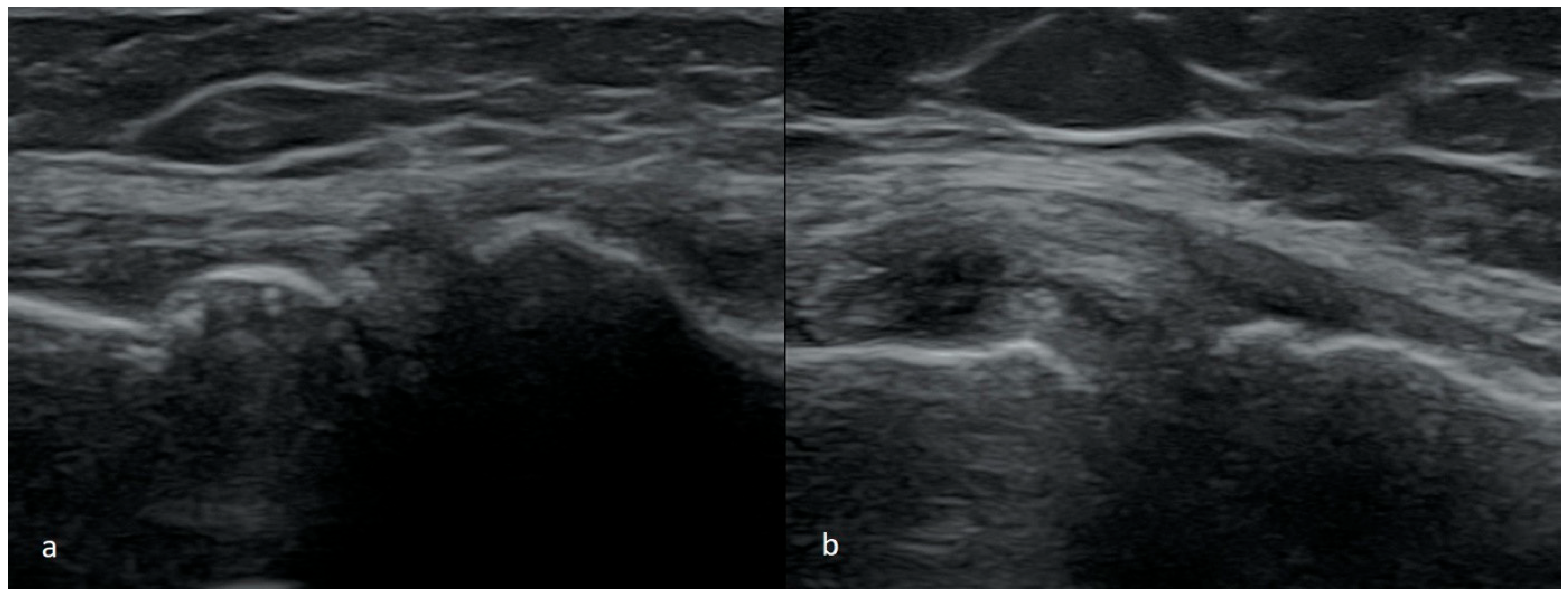 Medicina 61 01339 g005 Medicina 61 01339 g005
