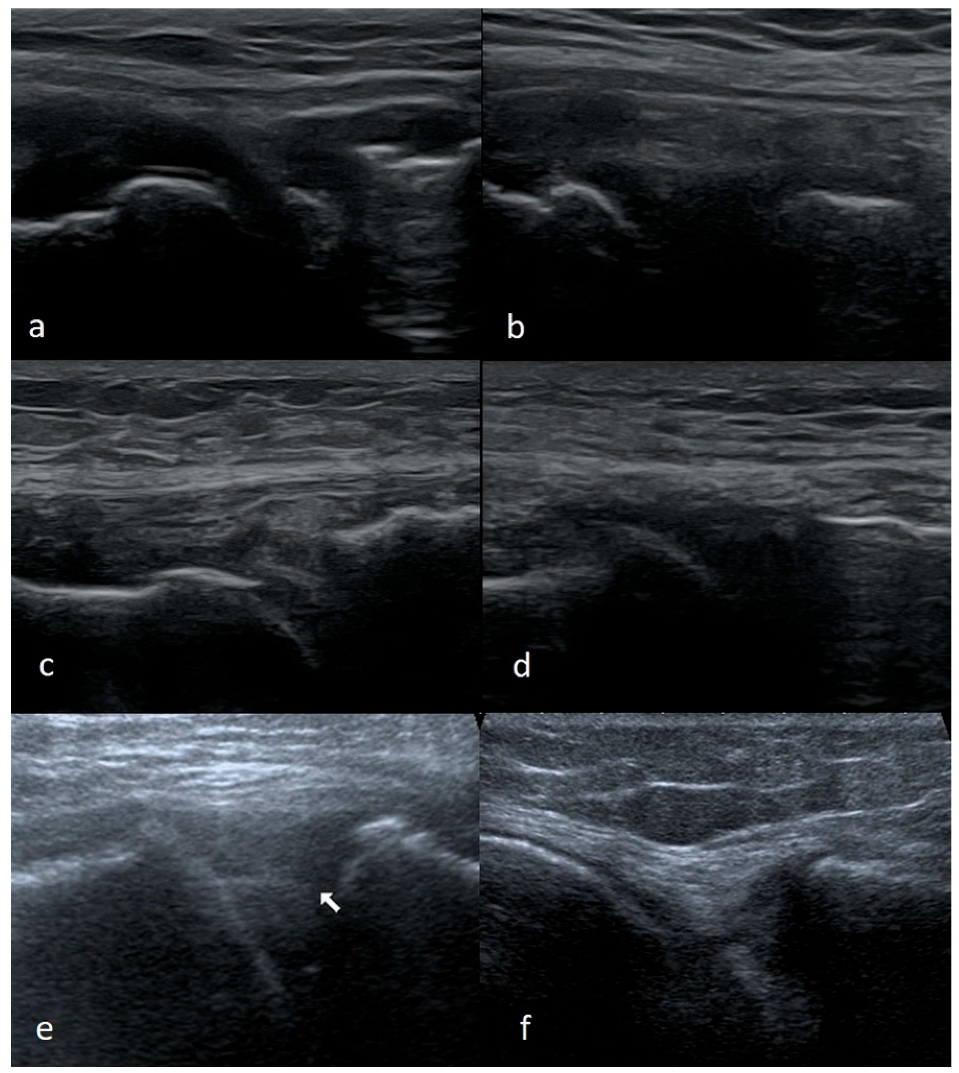 Medicina 61 01339 g006 Medicina 61 01339 g006