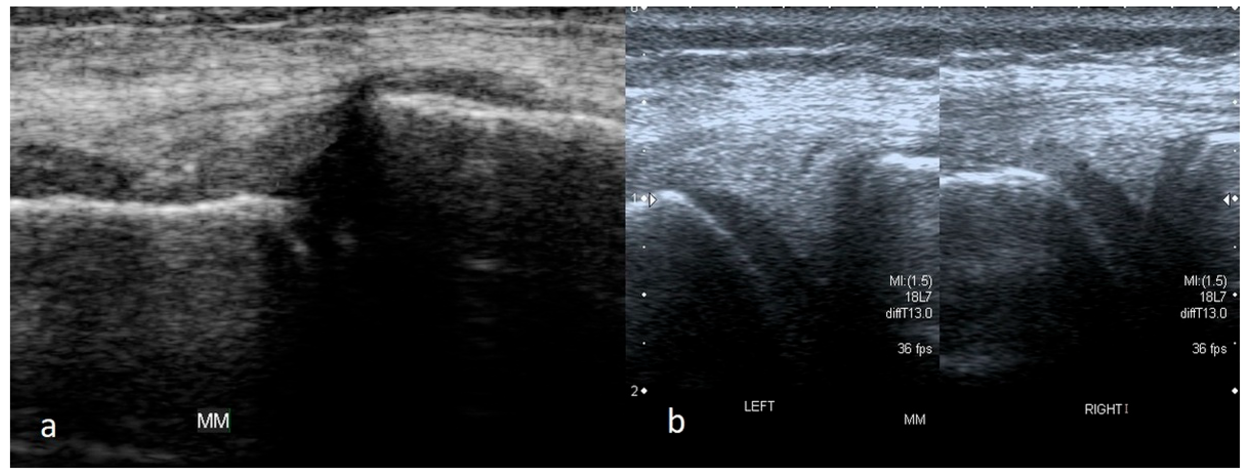 Medicina 61 01339 g007 Medicina 61 01339 g007