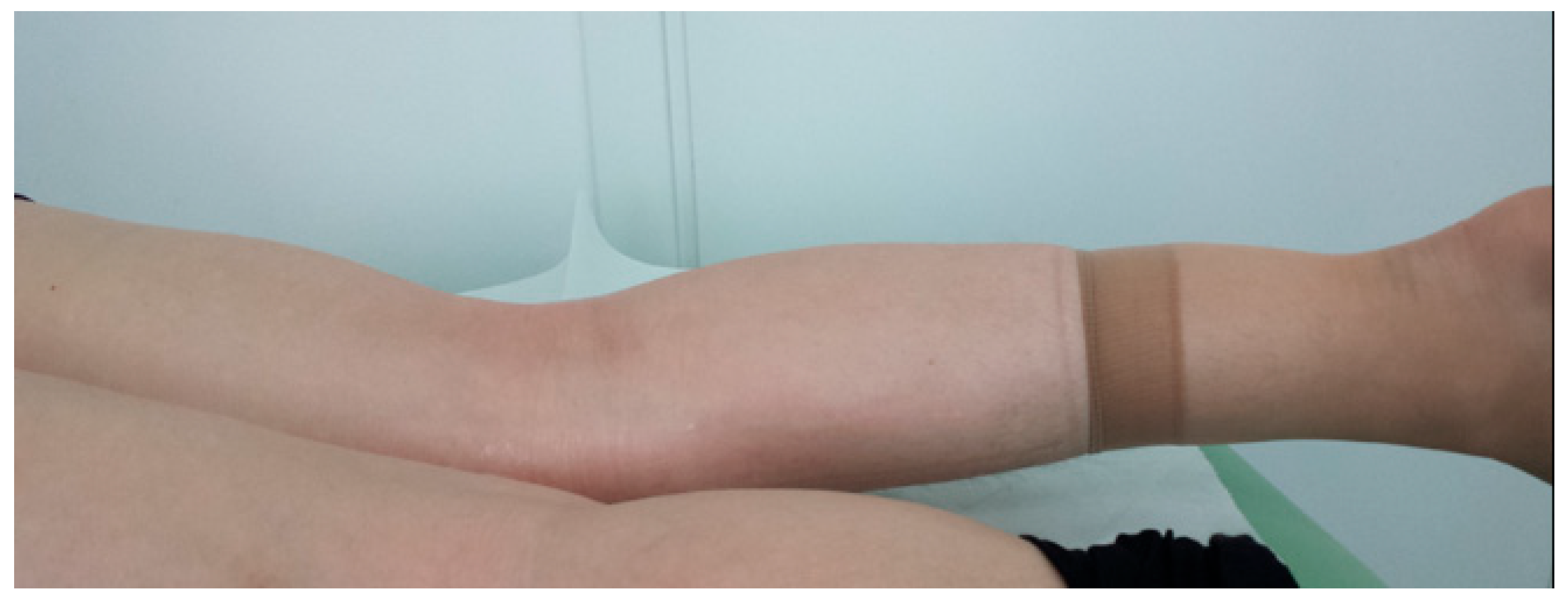 Medicina 61 01339 g008 Medicina 61 01339 g008