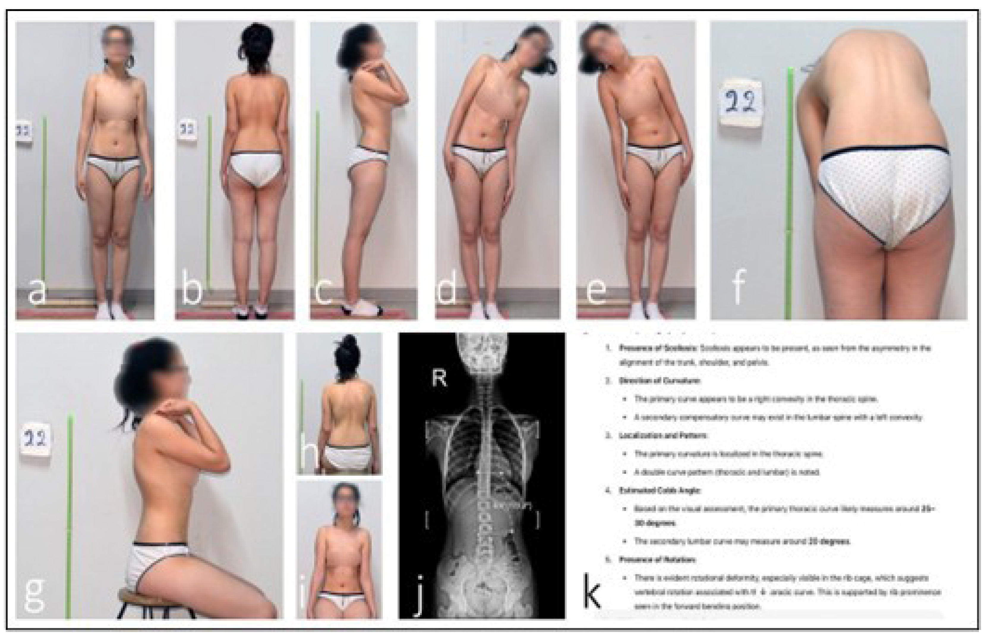 Medicina 61 01342 g004