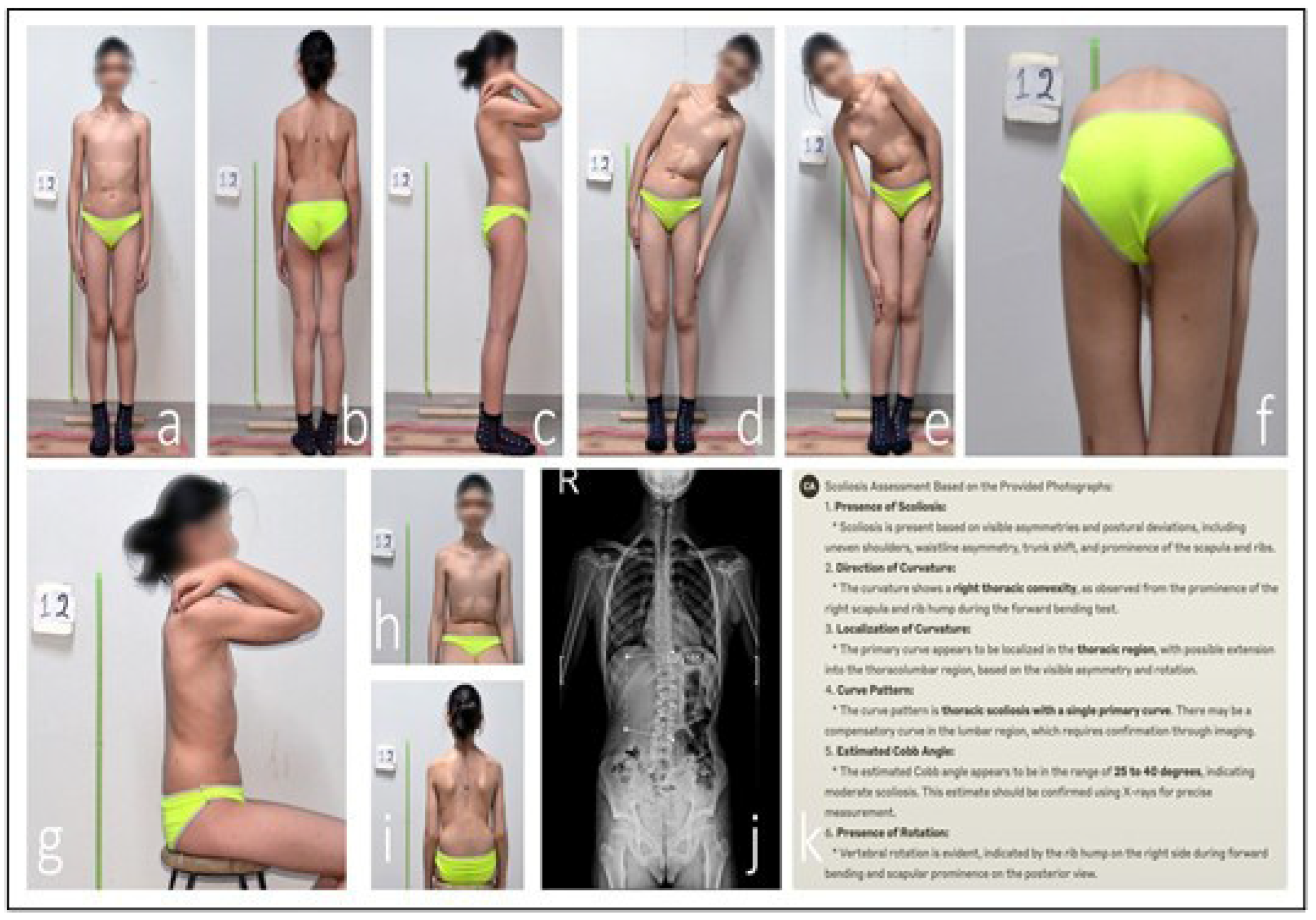 Medicina 61 01342 g005