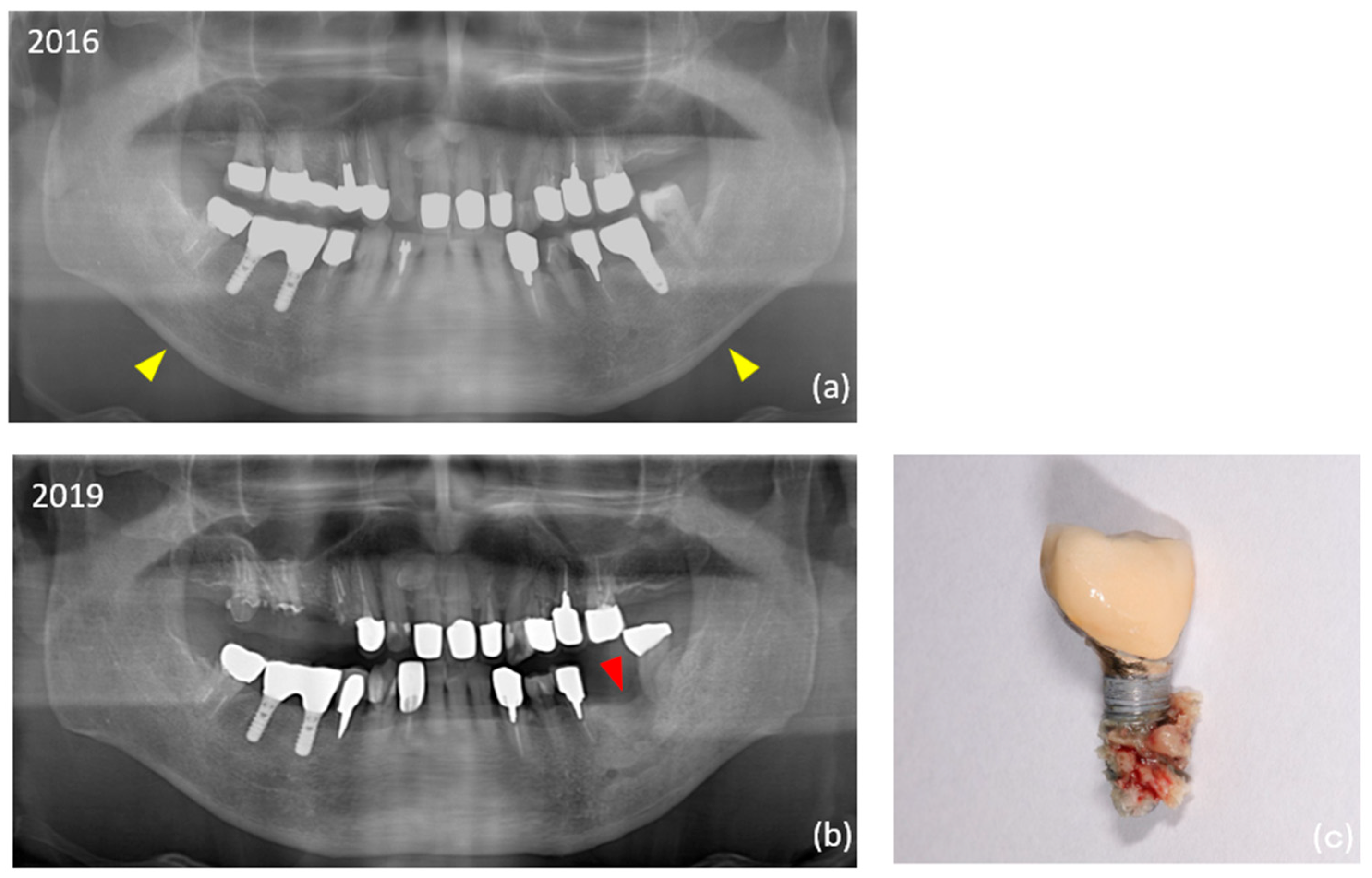 Medicina 61 01348 g002