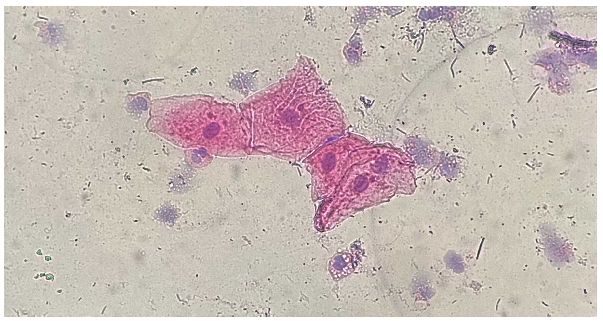 Medicina 61 01363 g004