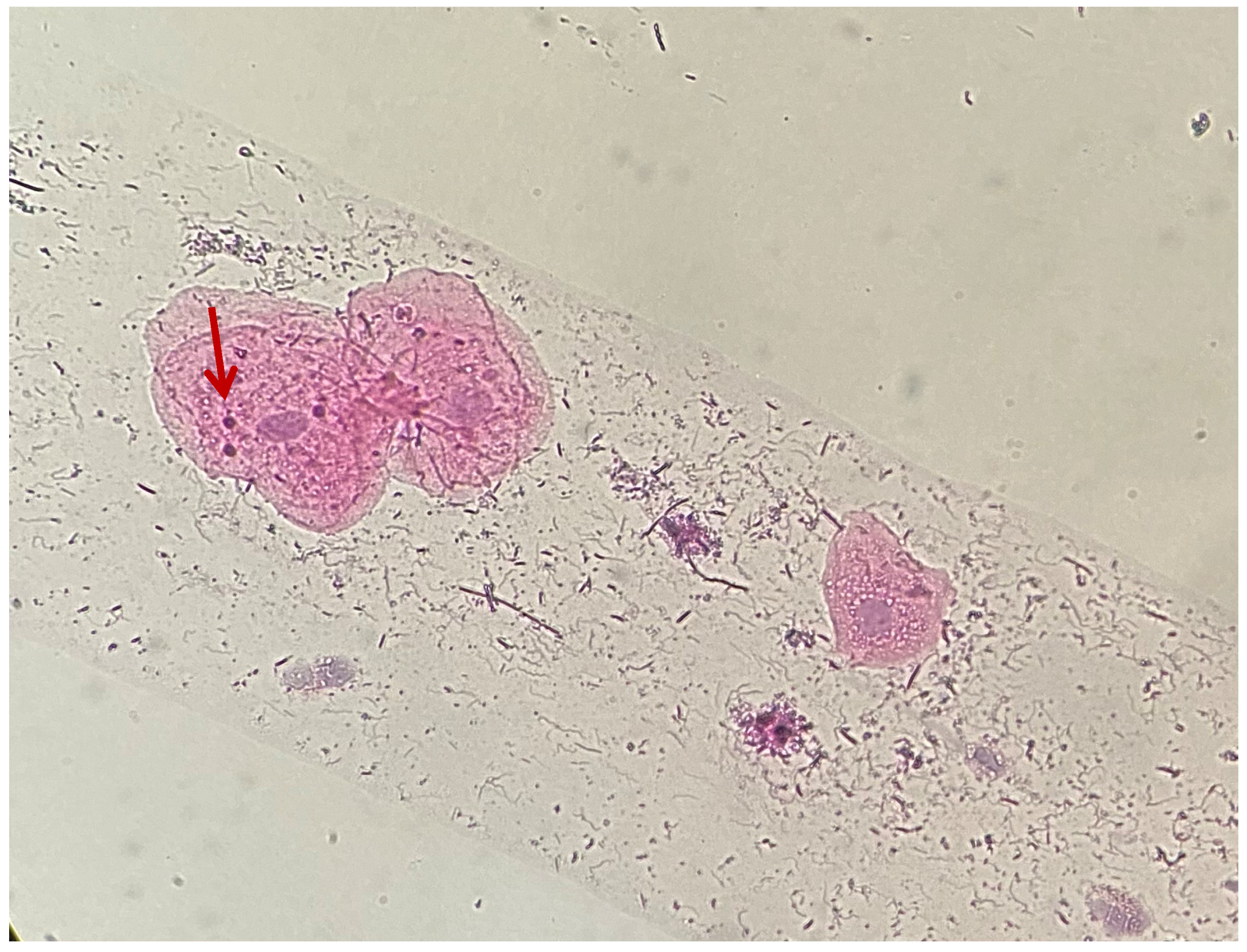 Medicina 61 01363 g005