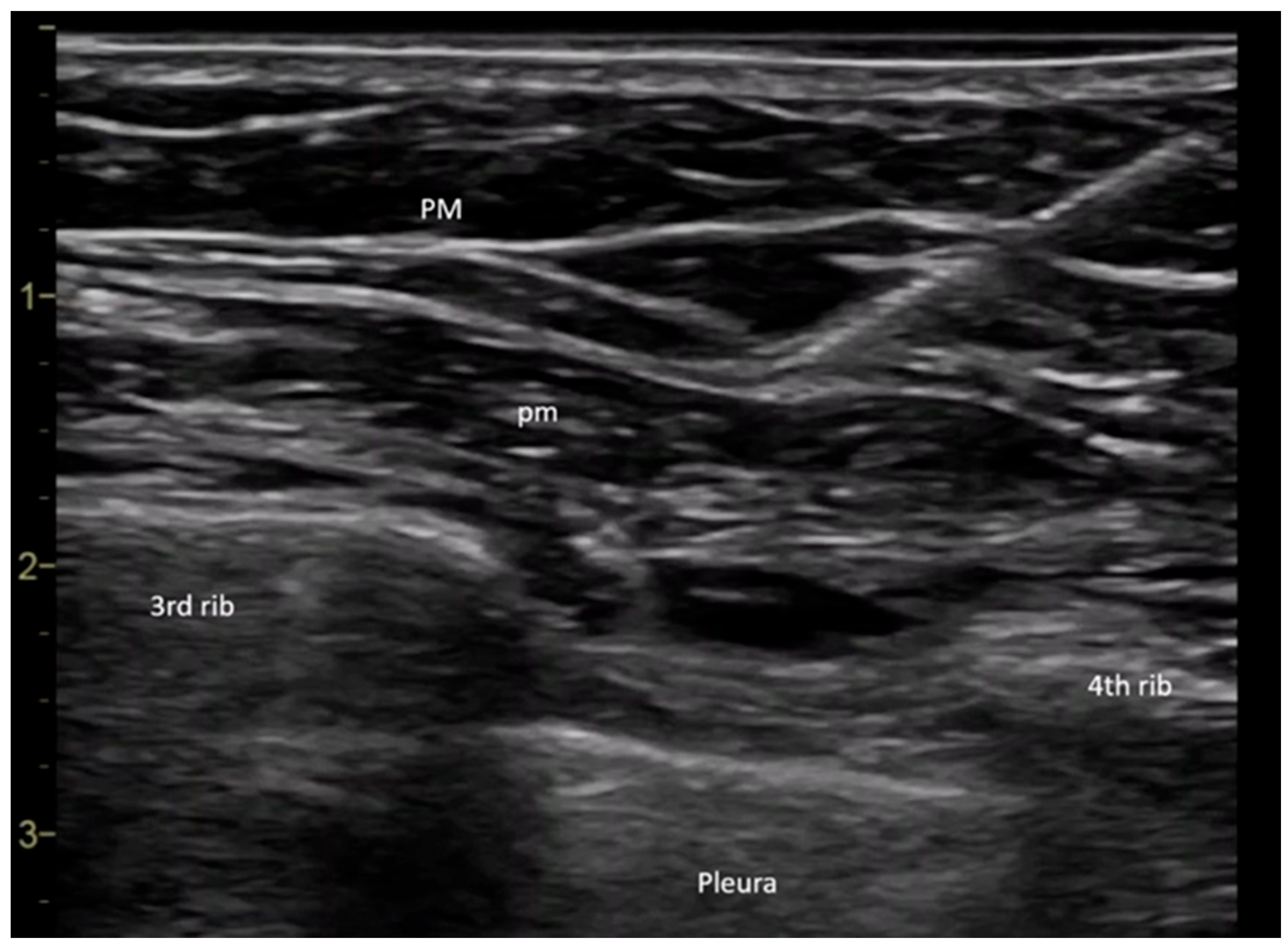 Medicina 61 01389 g001