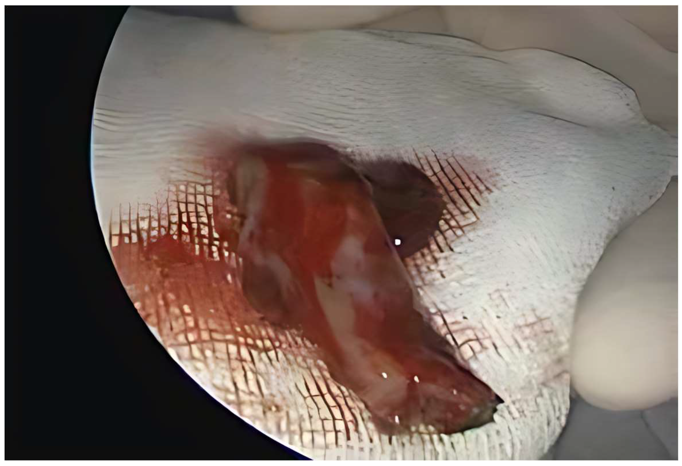 Medicina 61 01406 g002 Medicina 61 01406 g002