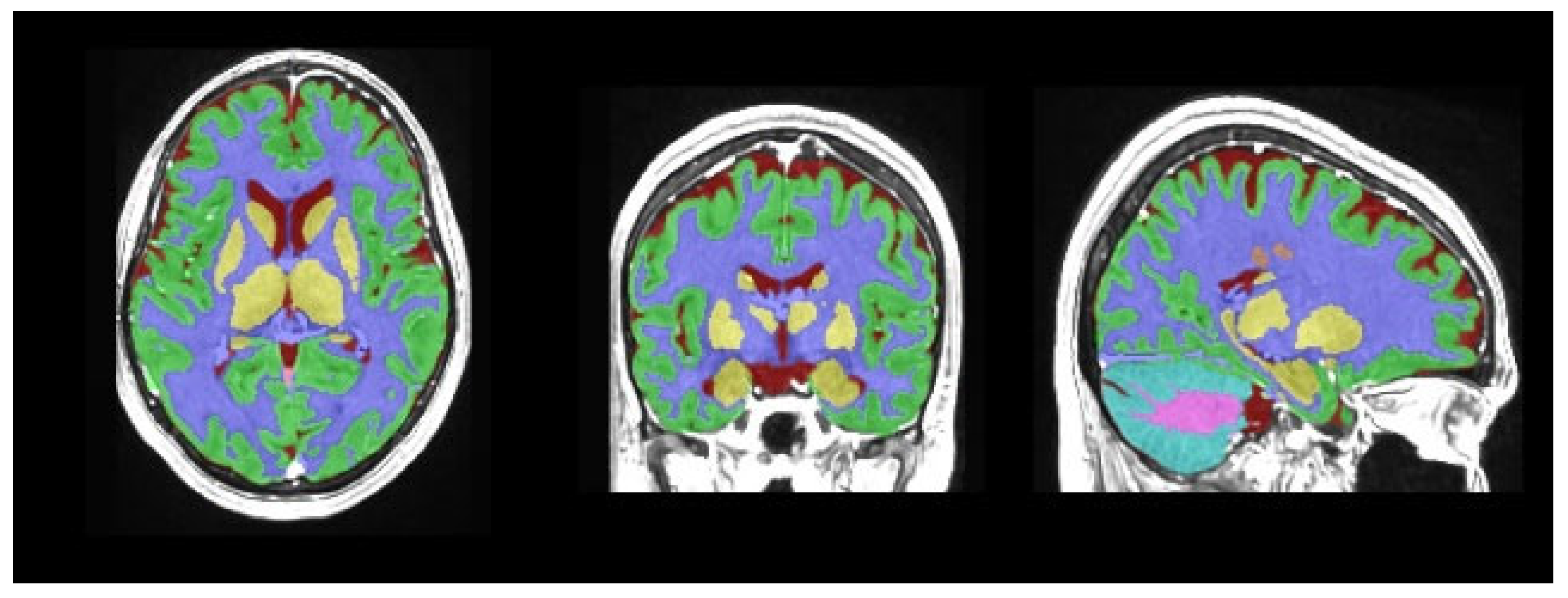 Medicina 61 01411 g001