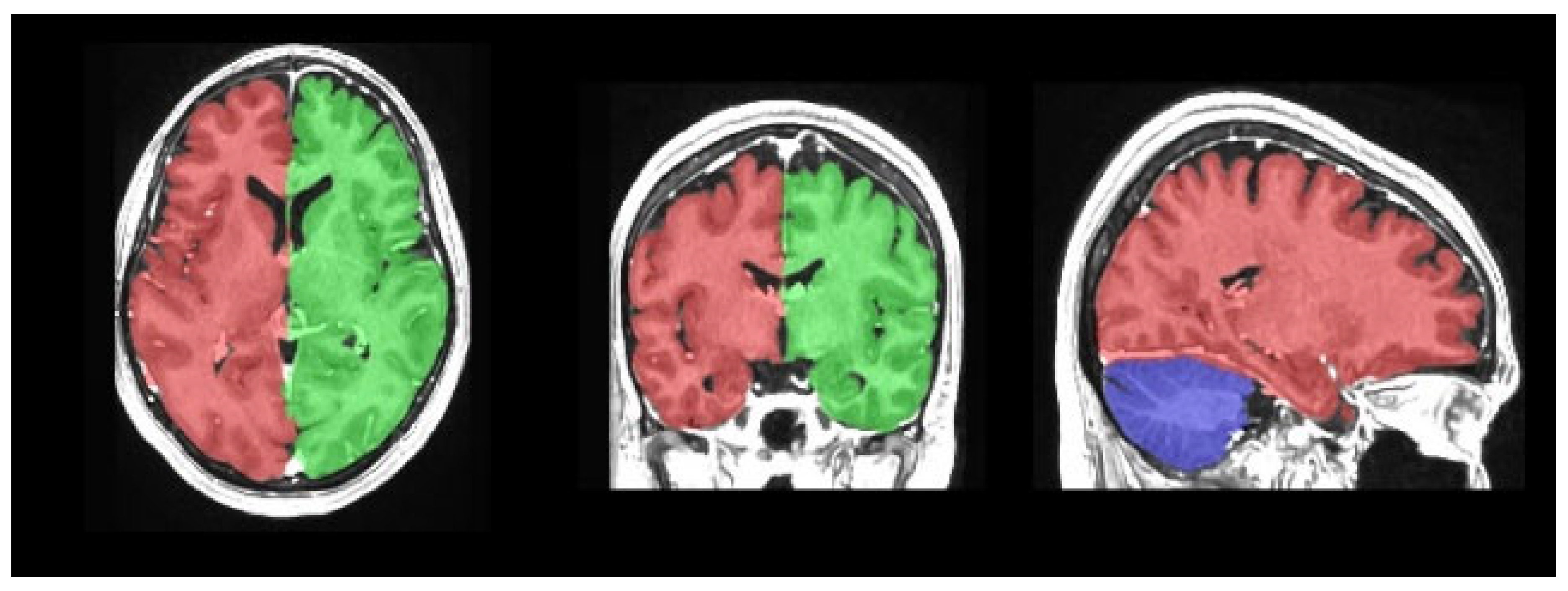 Medicina 61 01411 g002