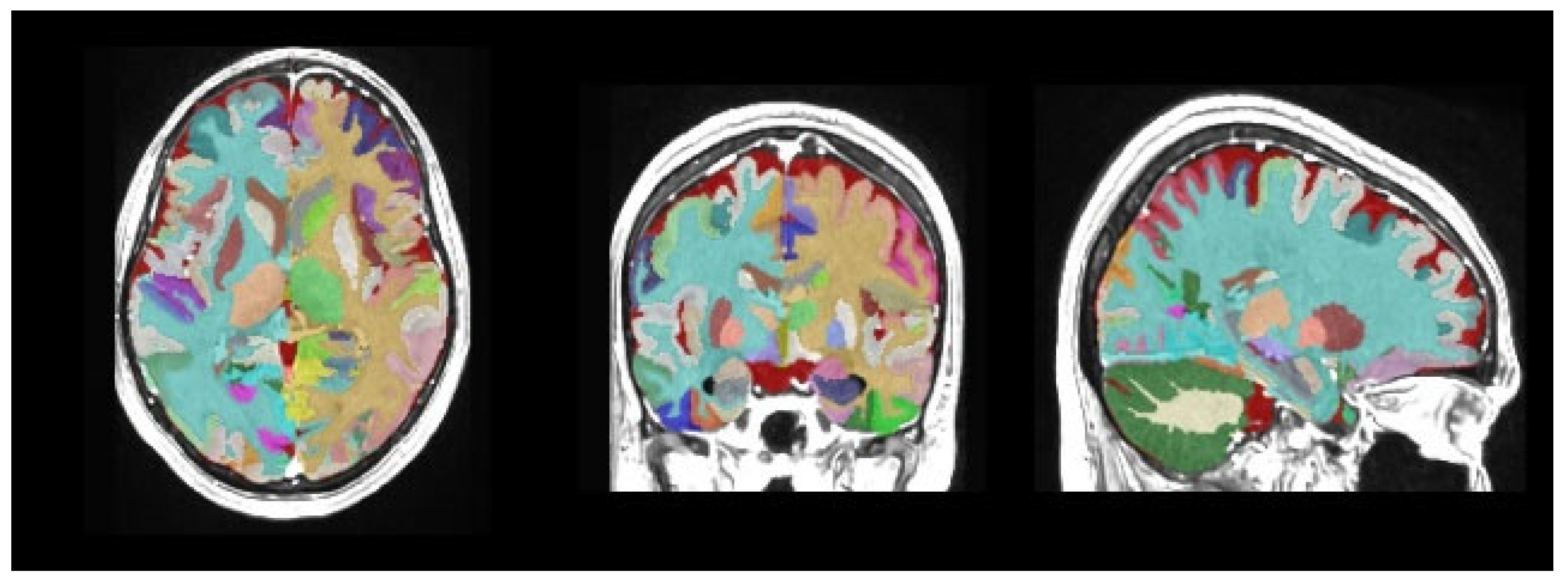 Medicina 61 01411 g003