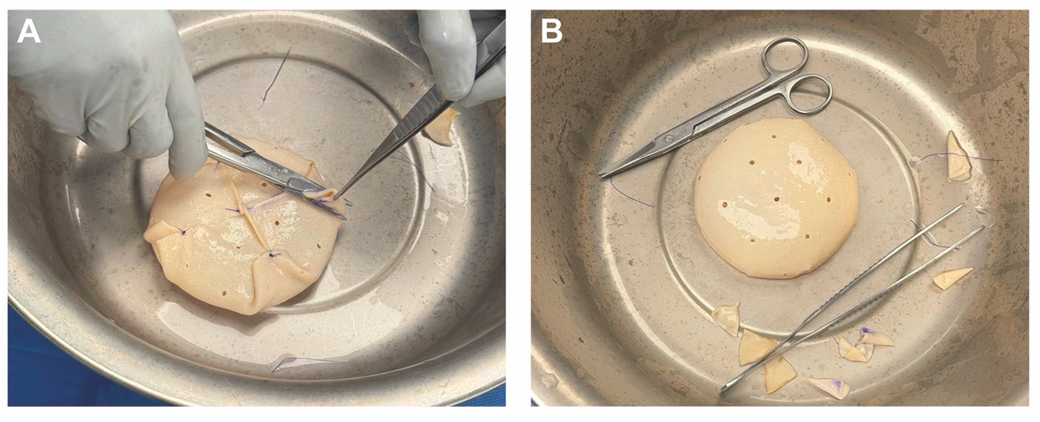 Medicina 61 01434 g003 Medicina 61 01434 g003
