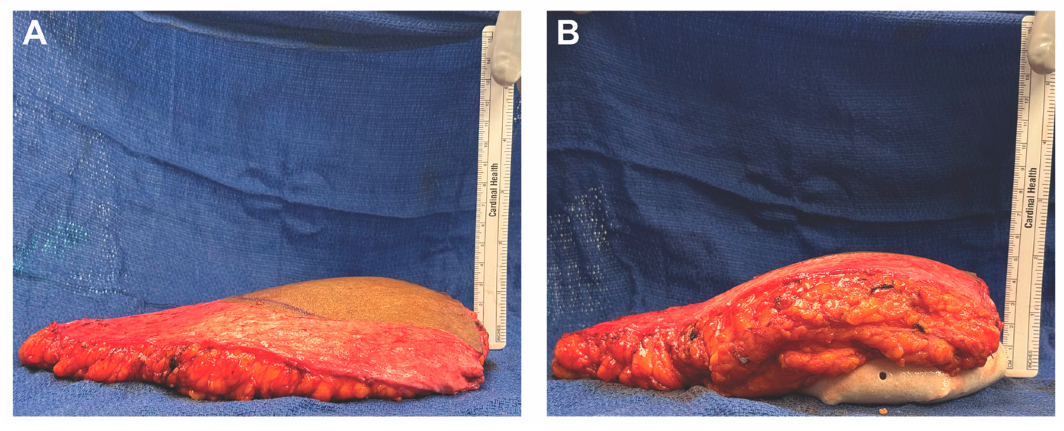 Medicina 61 01434 g004 Medicina 61 01434 g004