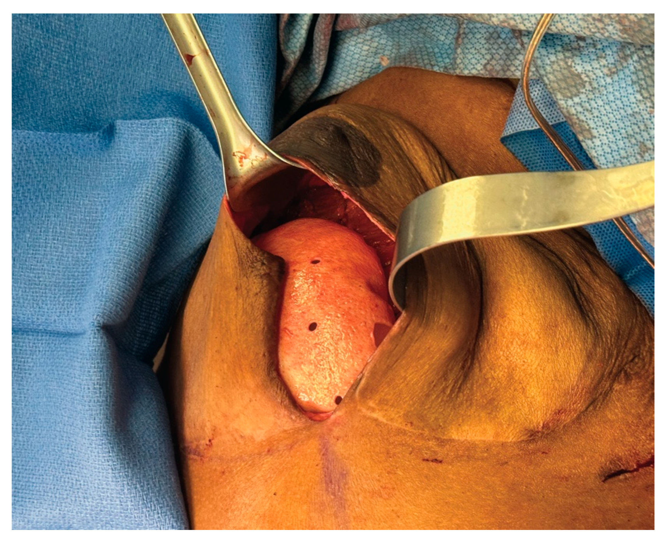 Medicina 61 01434 g005 Medicina 61 01434 g005