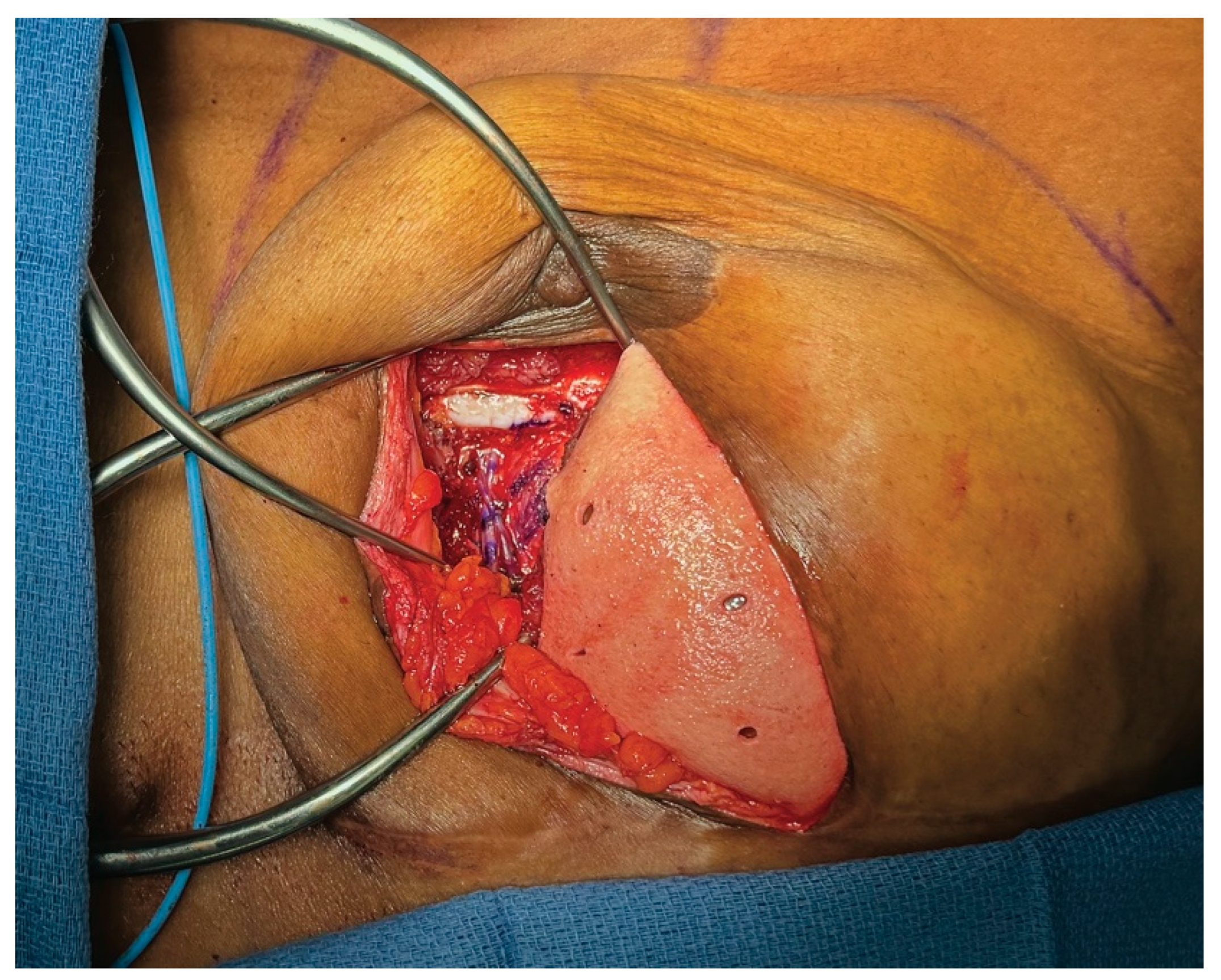 Medicina 61 01434 g006 Medicina 61 01434 g006